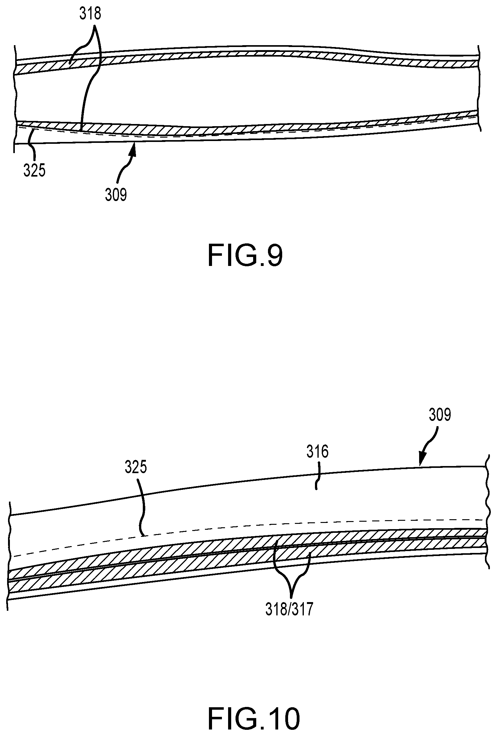 Patent US12303645 Figure 5 – Headgear for a patient interface