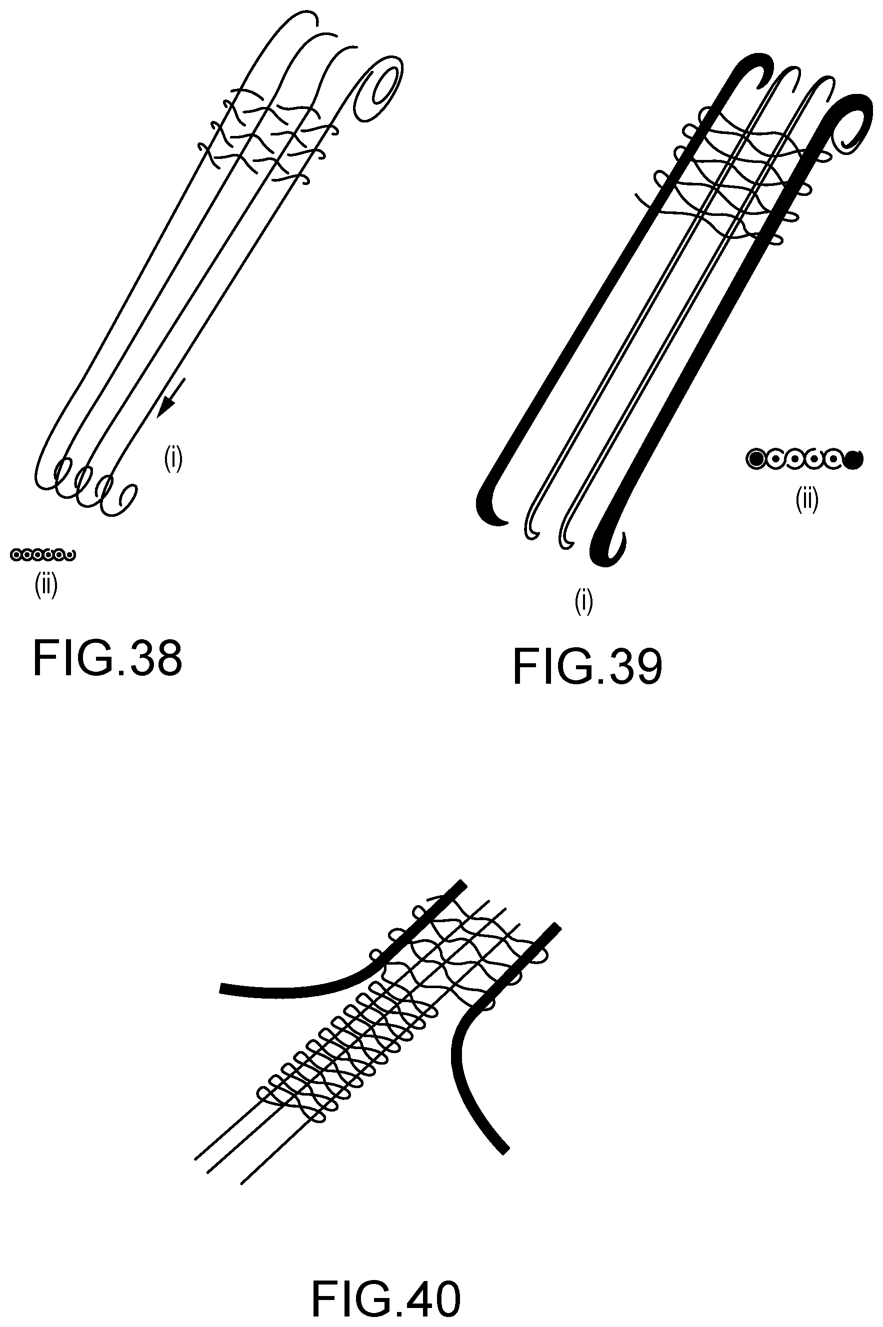 Patent US12303645 Figure 17 – Headgear for a patient interface