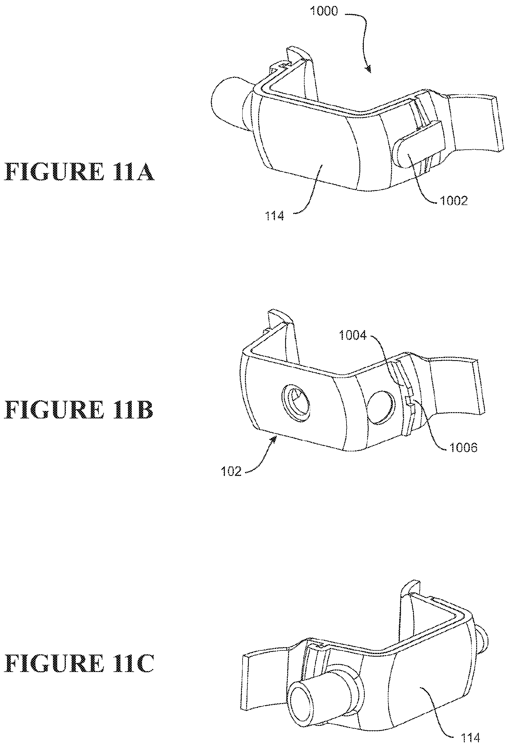 Patent US12303646 Figure 18 – Patient interface and component parts