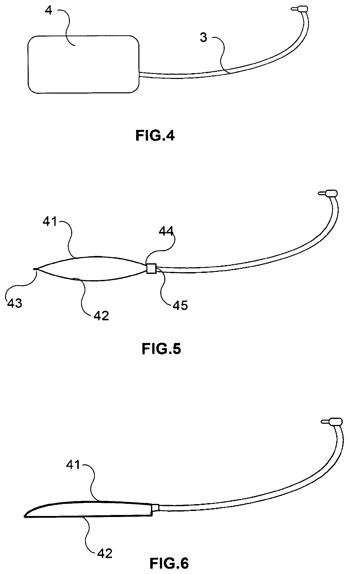 Patent US12303648 Figure 5 – Device to prevent apnea episodes in infants