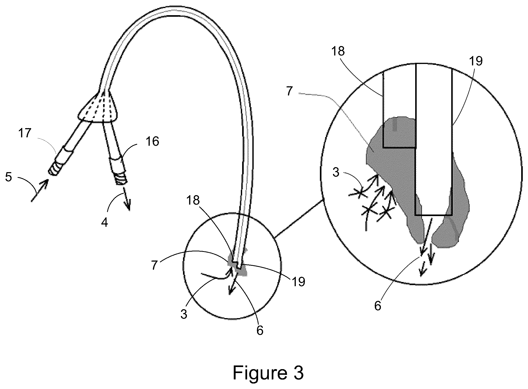Patent US12303649 Figure 2 – Catheter clearance device and method of use