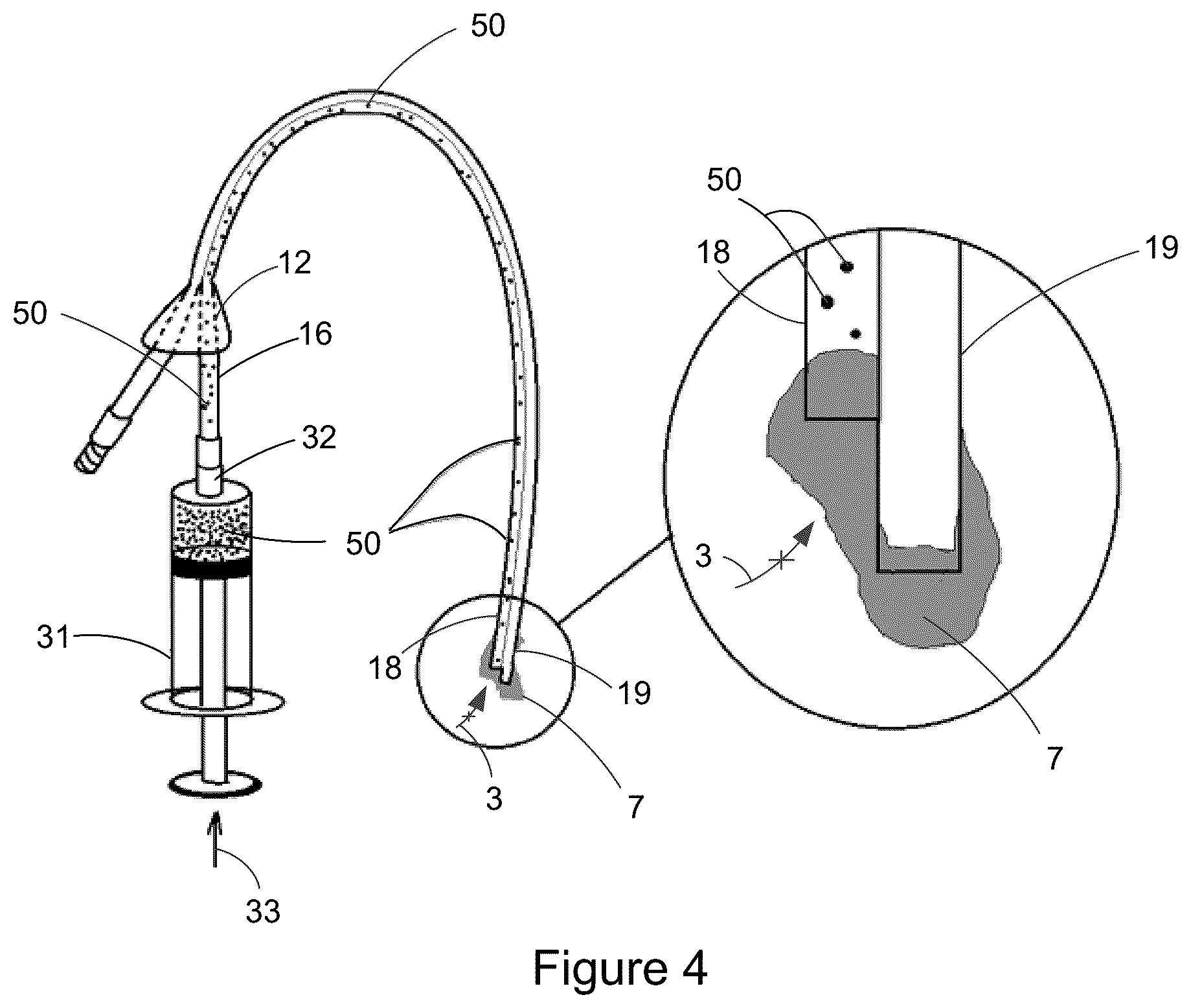 Patent US12303649 Figure 3 – Catheter clearance device and method of use