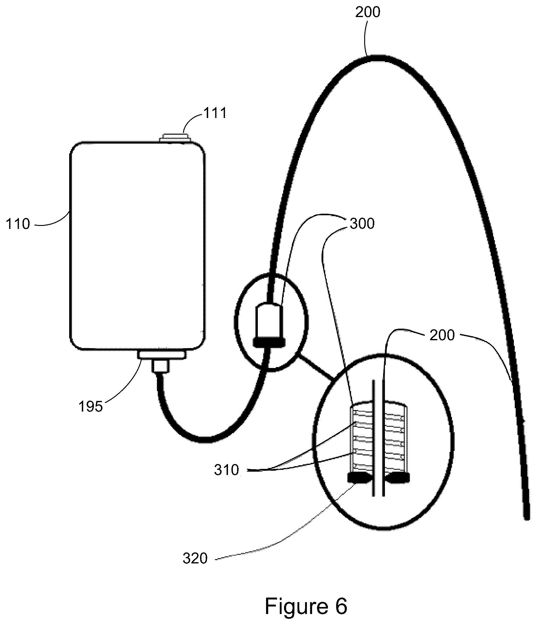 Patent US12303649 Figure 5 – Catheter clearance device and method of use