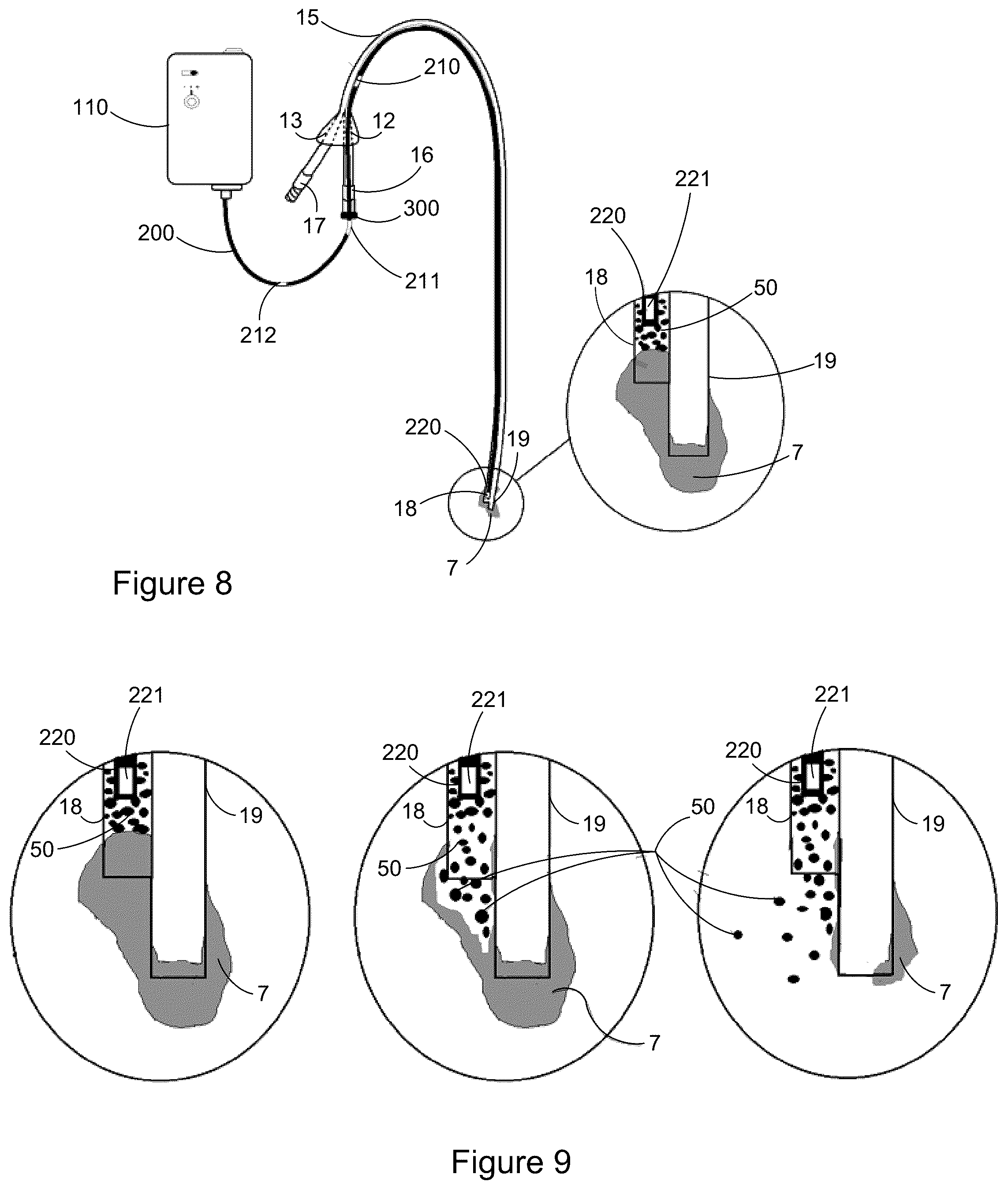 Patent US12303649 Figure 7 – Catheter clearance device and method of use