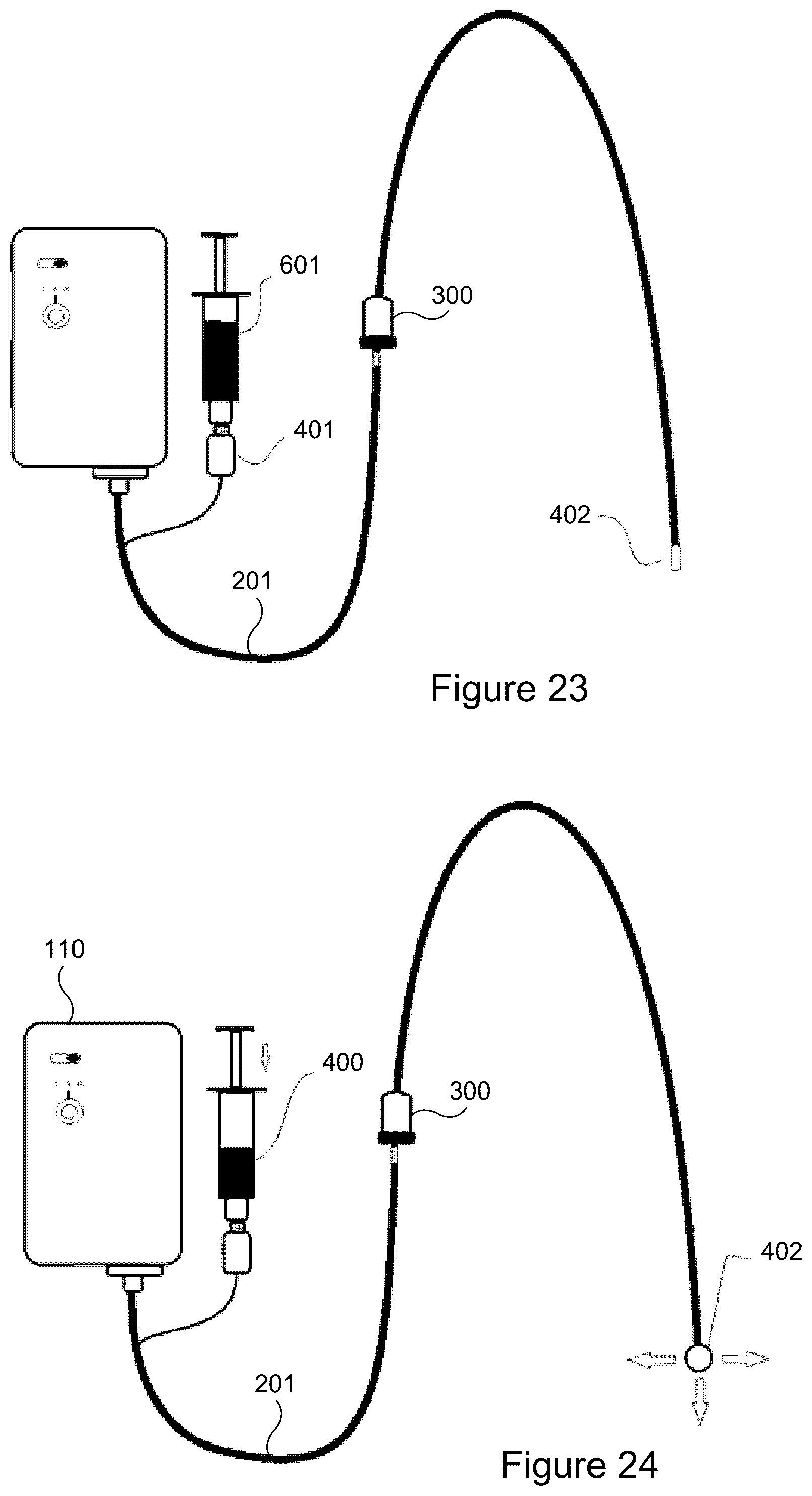 Patent US12303649 Figure 18 – Catheter clearance device and method of use
