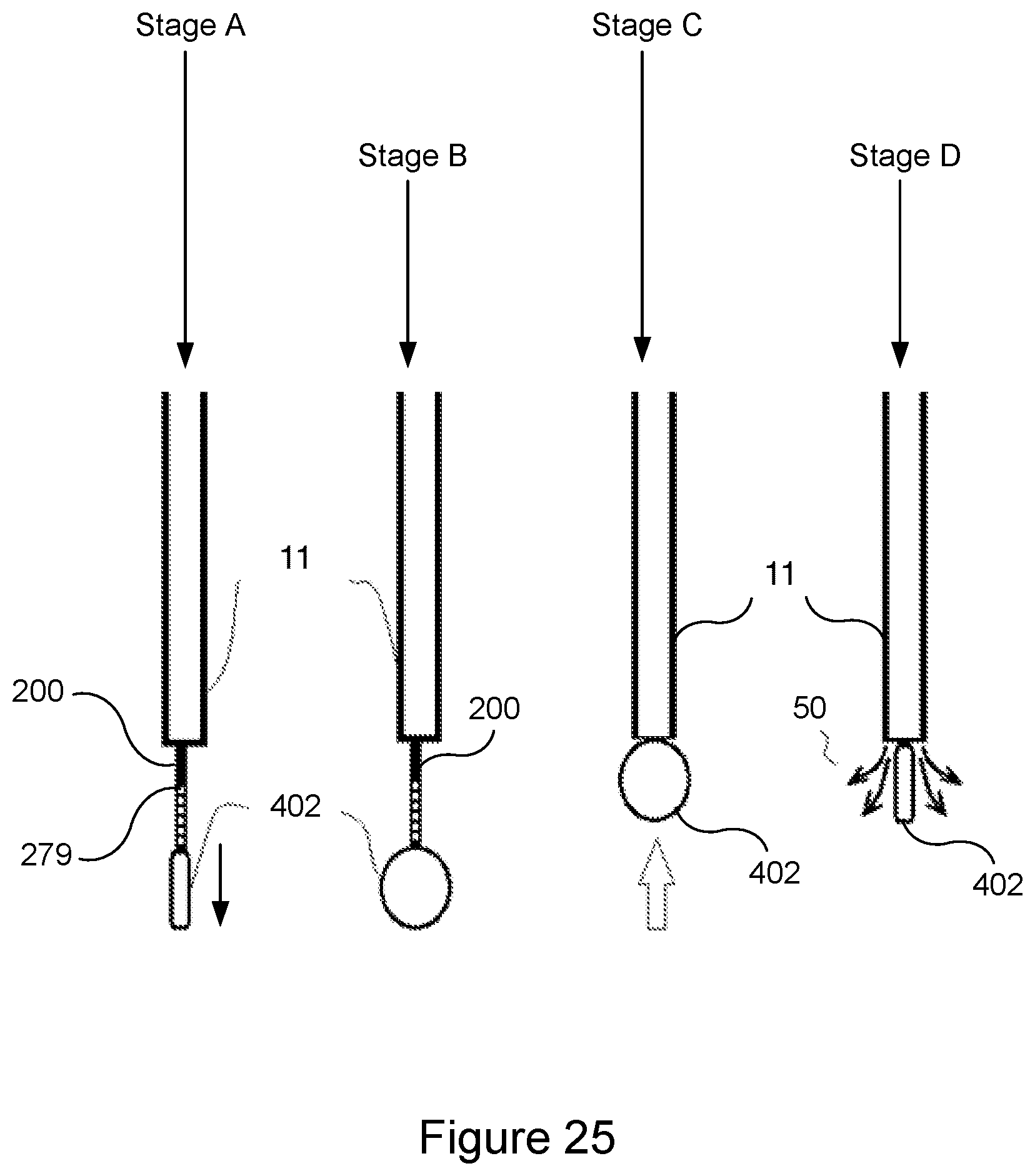 Patent US12303649 Figure 19 – Catheter clearance device and method of use