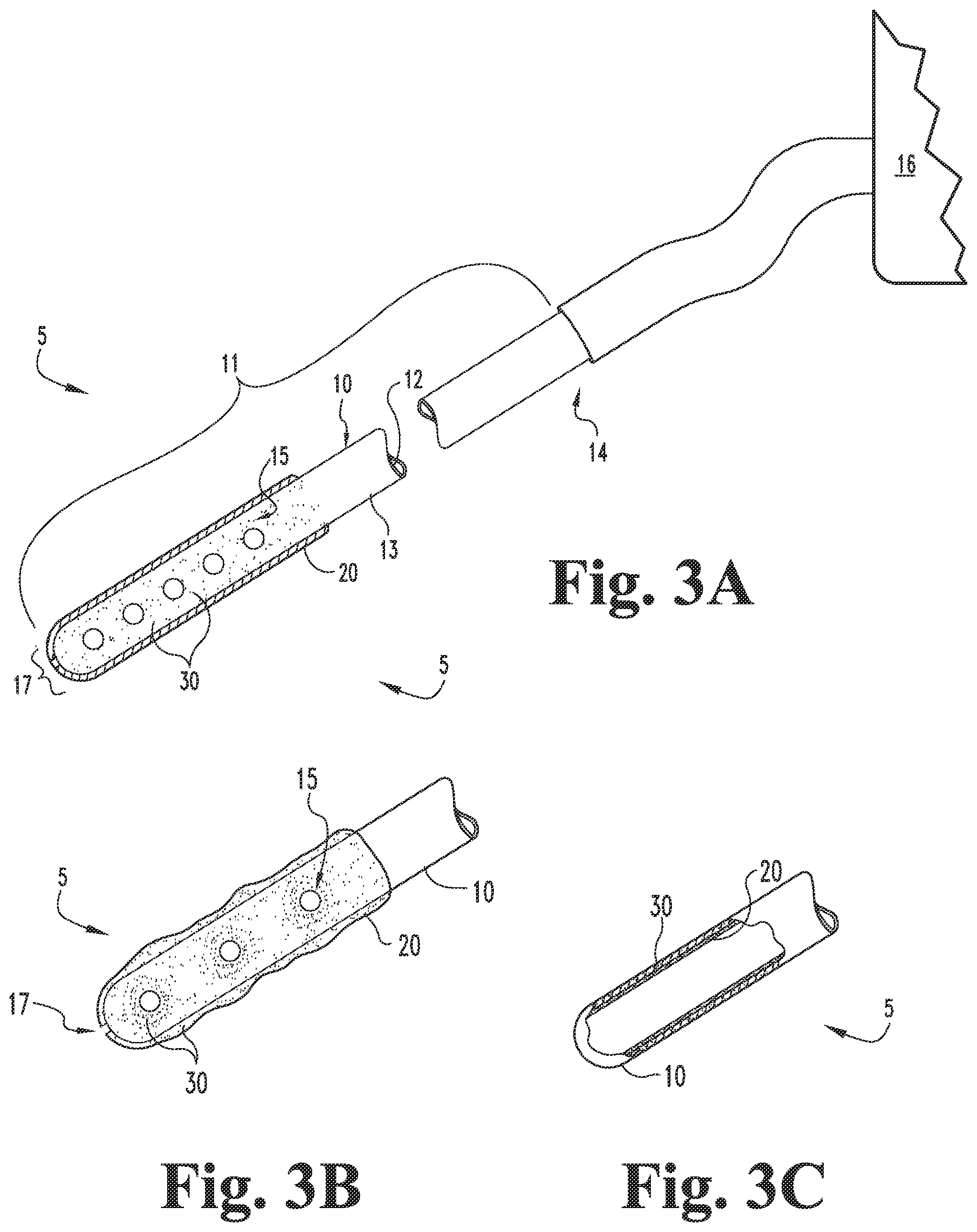 Patent US12303650 Figure 3 – Self-clearing catheters and methods of use thereof