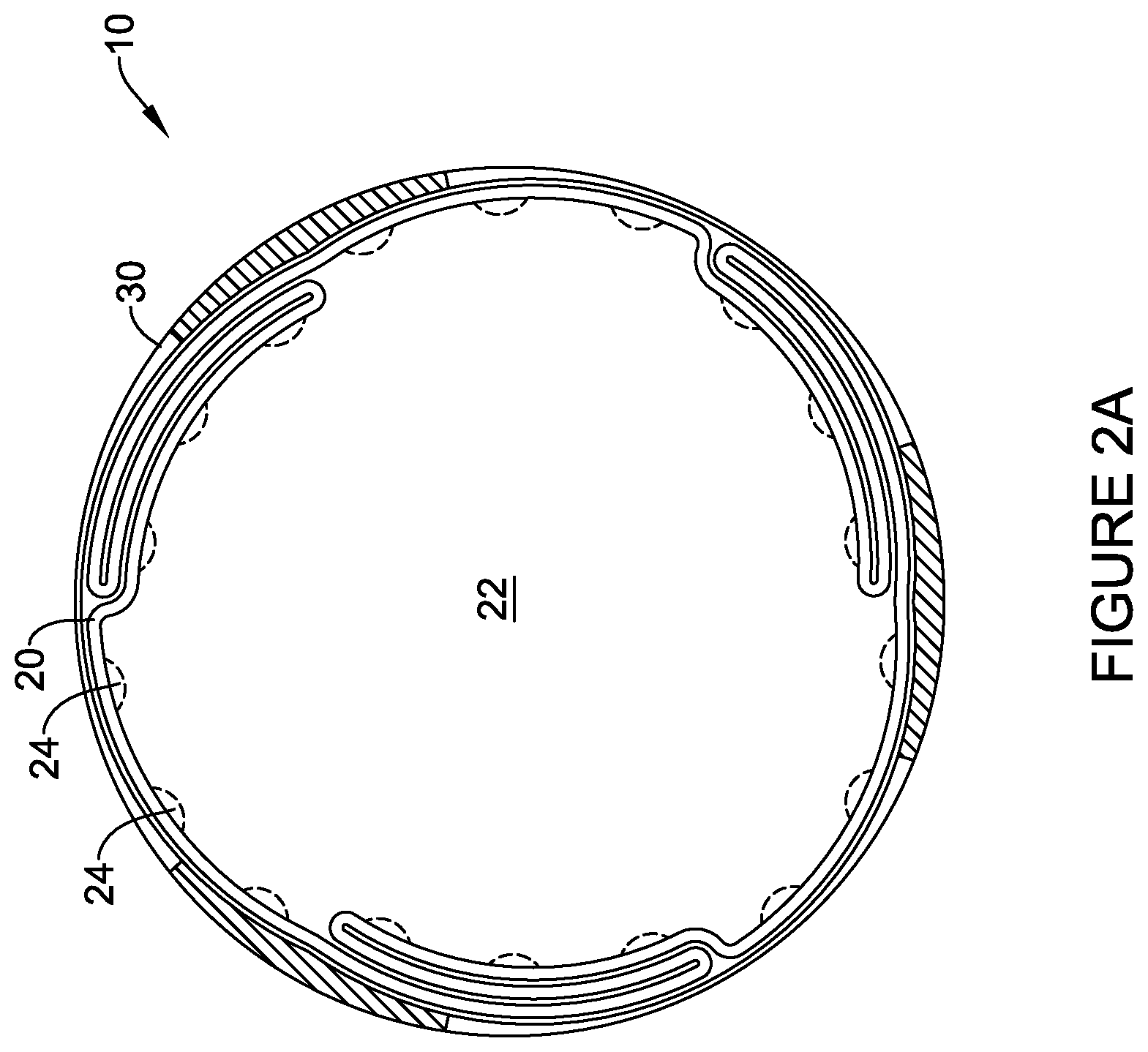 Patent US12303651 Figure 2 – Fully compliant large bore expandable sheath