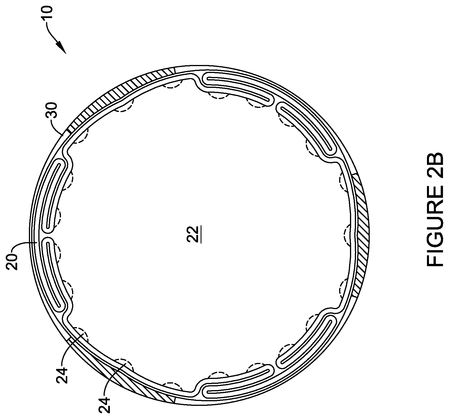 Patent US12303651 Figure 3 – Fully compliant large bore expandable sheath
