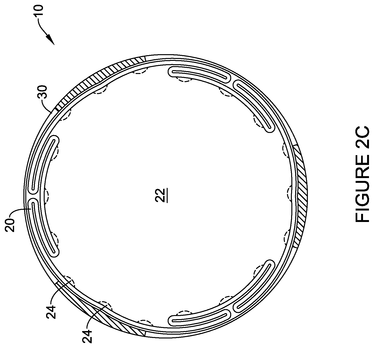 Patent US12303651 Figure 4 – Fully compliant large bore expandable sheath