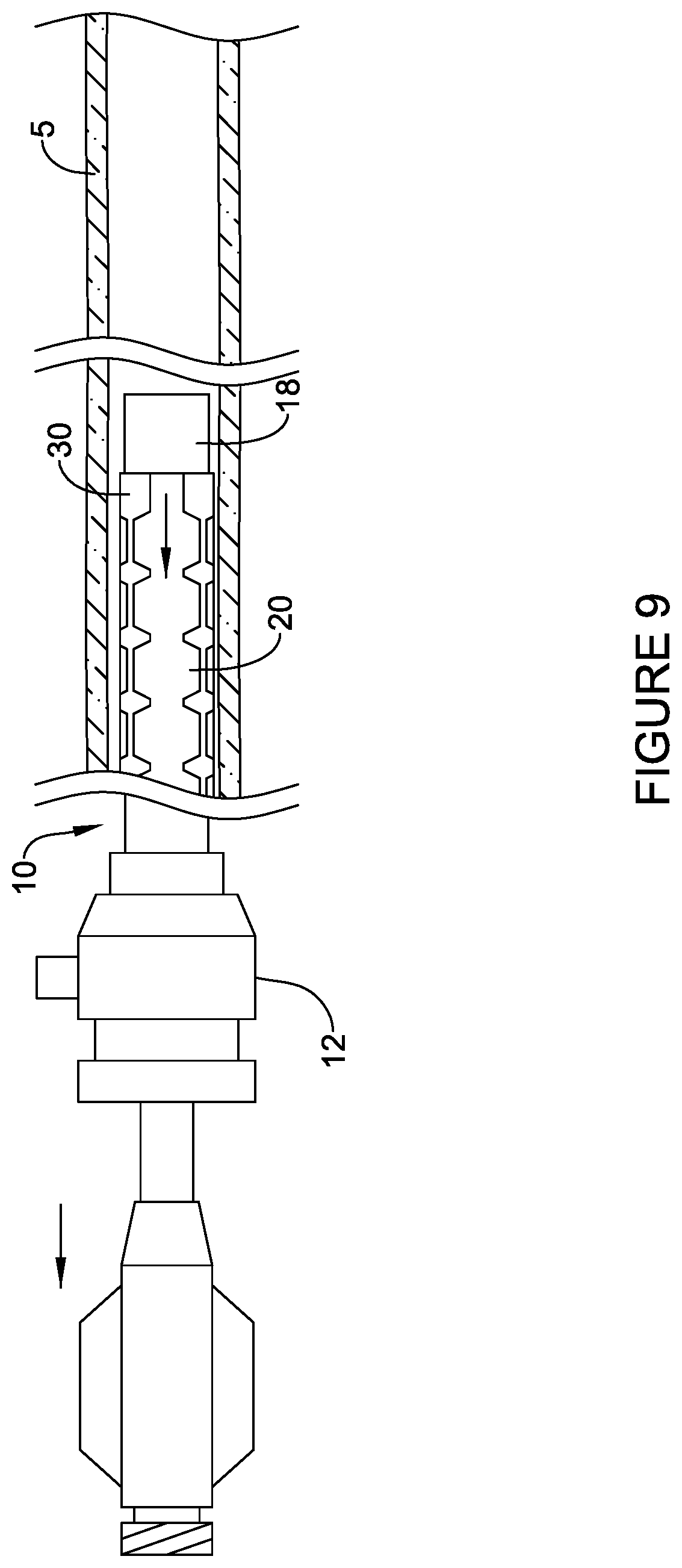 Patent US12303651 Figure 12 – Fully compliant large bore expandable sheath