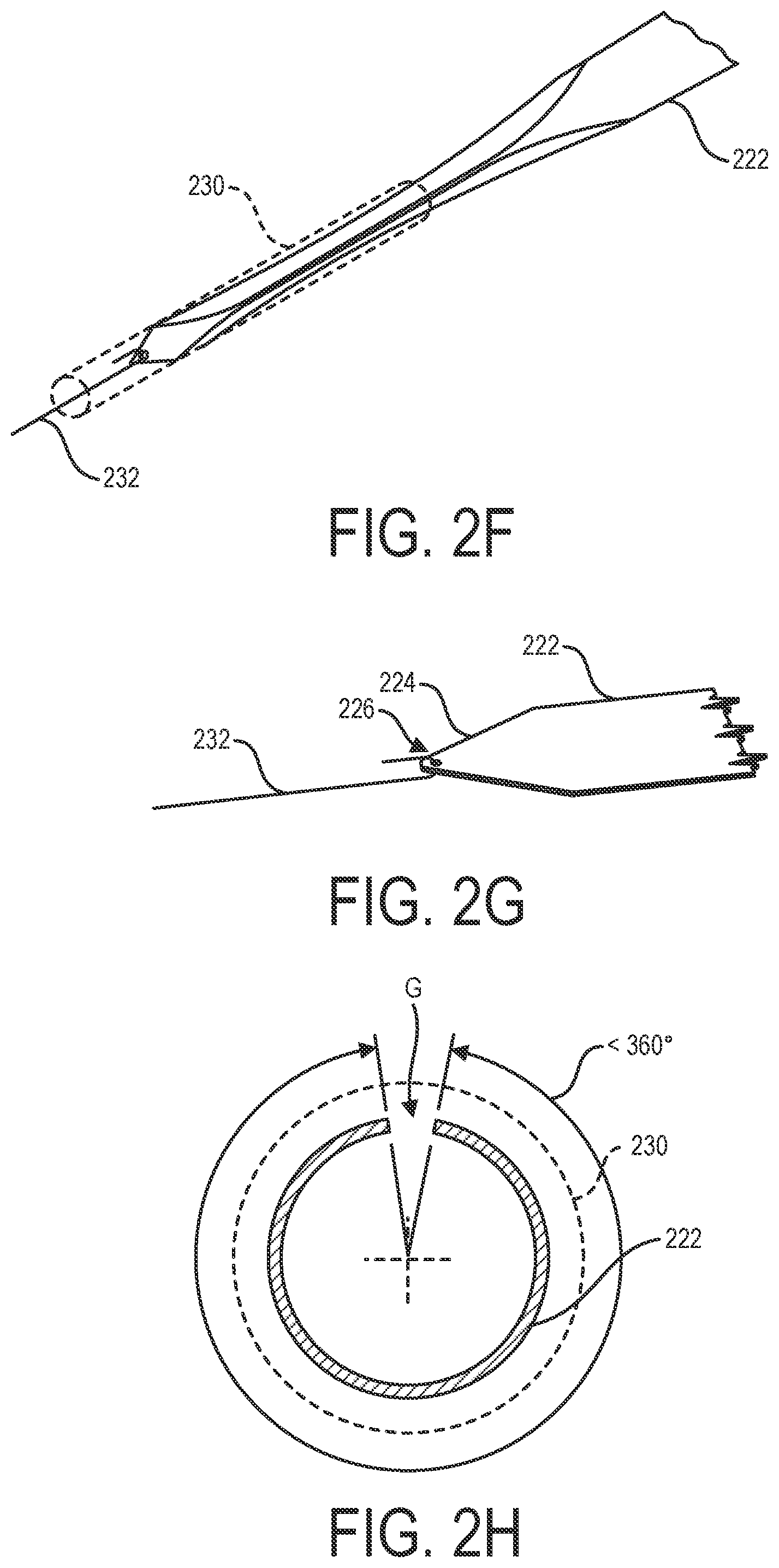 Patent US12303652 Figure 4 – Catheters and related devices and methods of manufacture
