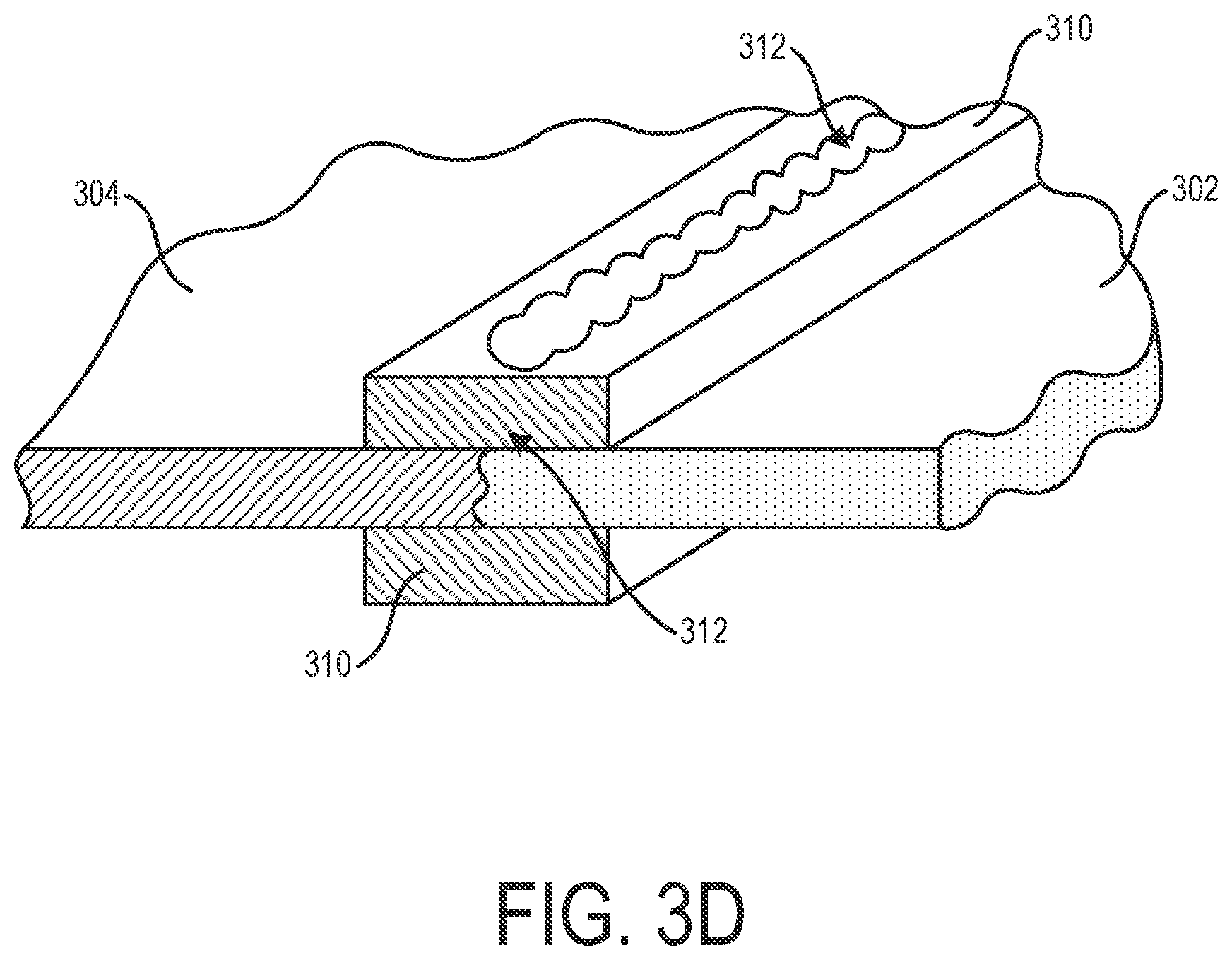 Patent US12303652 Figure 10 – Catheters and related devices and methods of manufacture