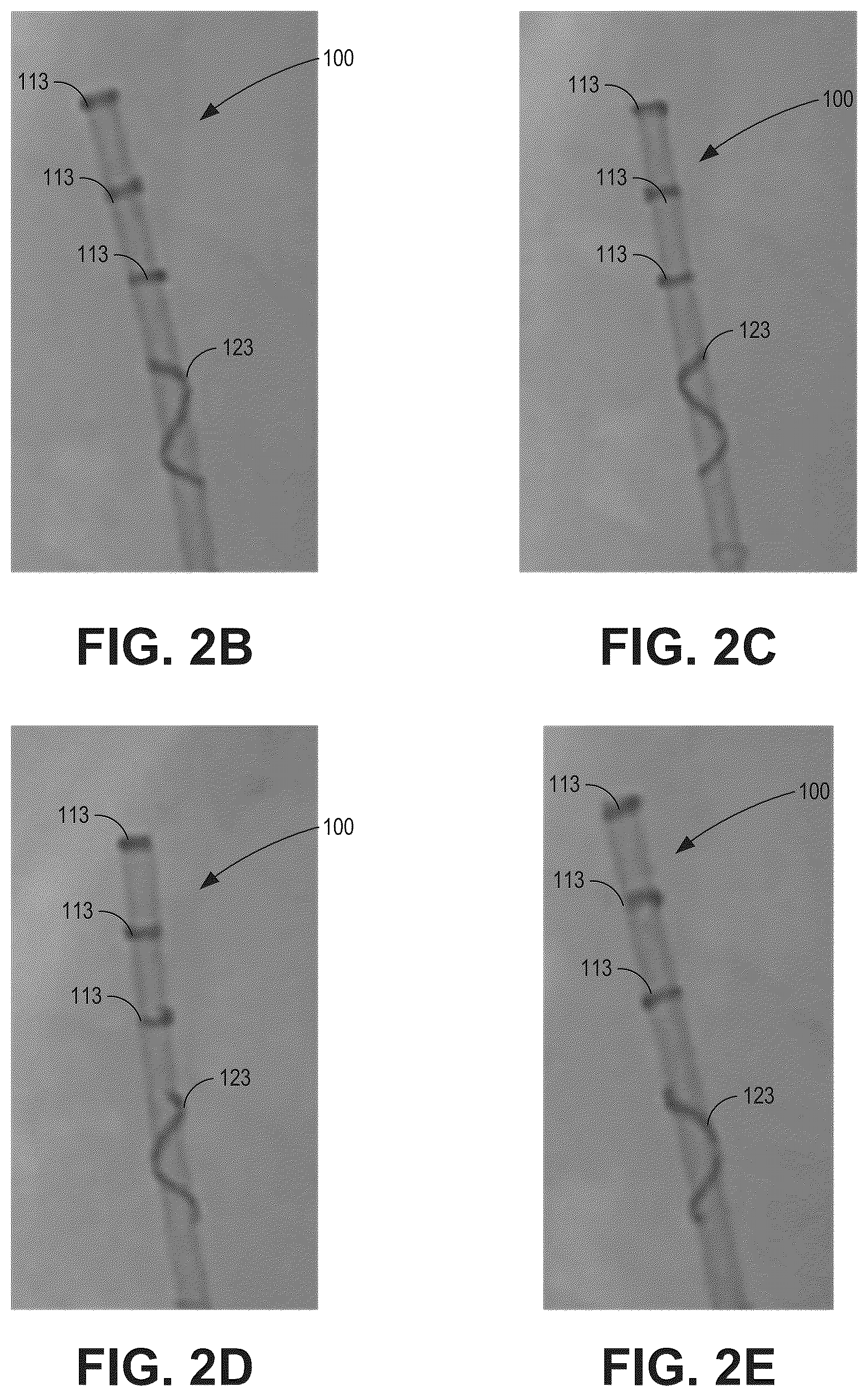 Patent US12303656 Figure 3 – Image space controlled manual catheter