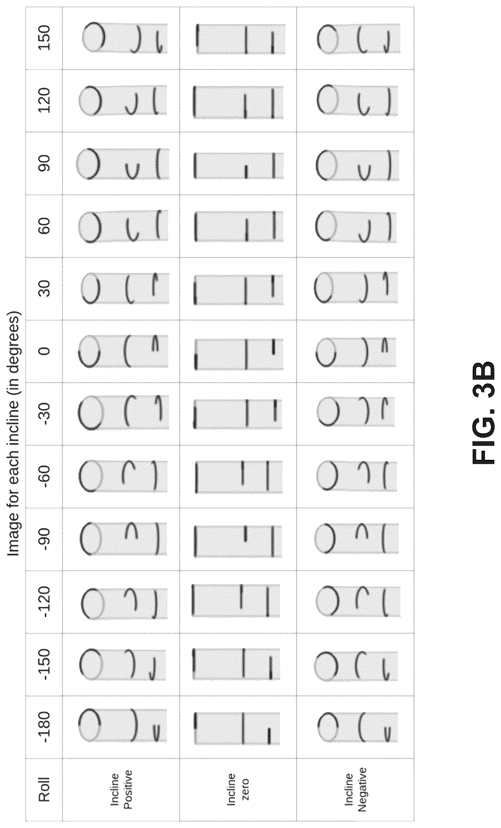 Patent US12303656 Figure 5 – Image space controlled manual catheter