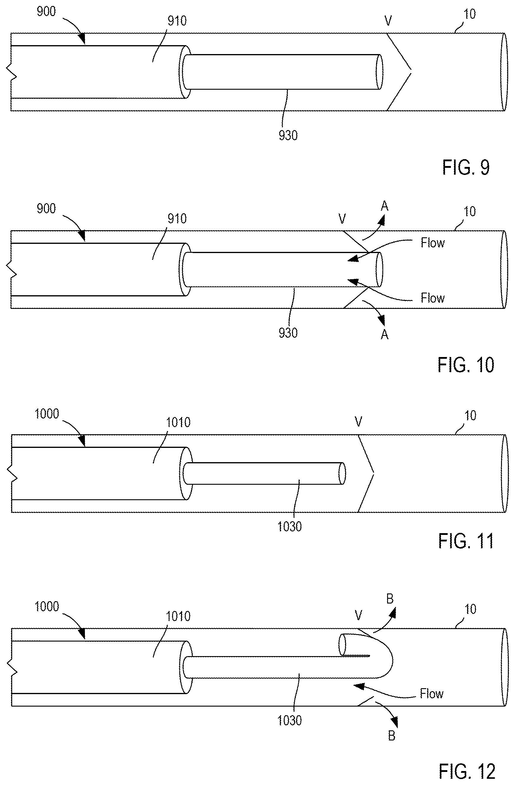 Patent US12303658 Figure 4 – Support devices for bodily fluid transfer systems and methods of using the same