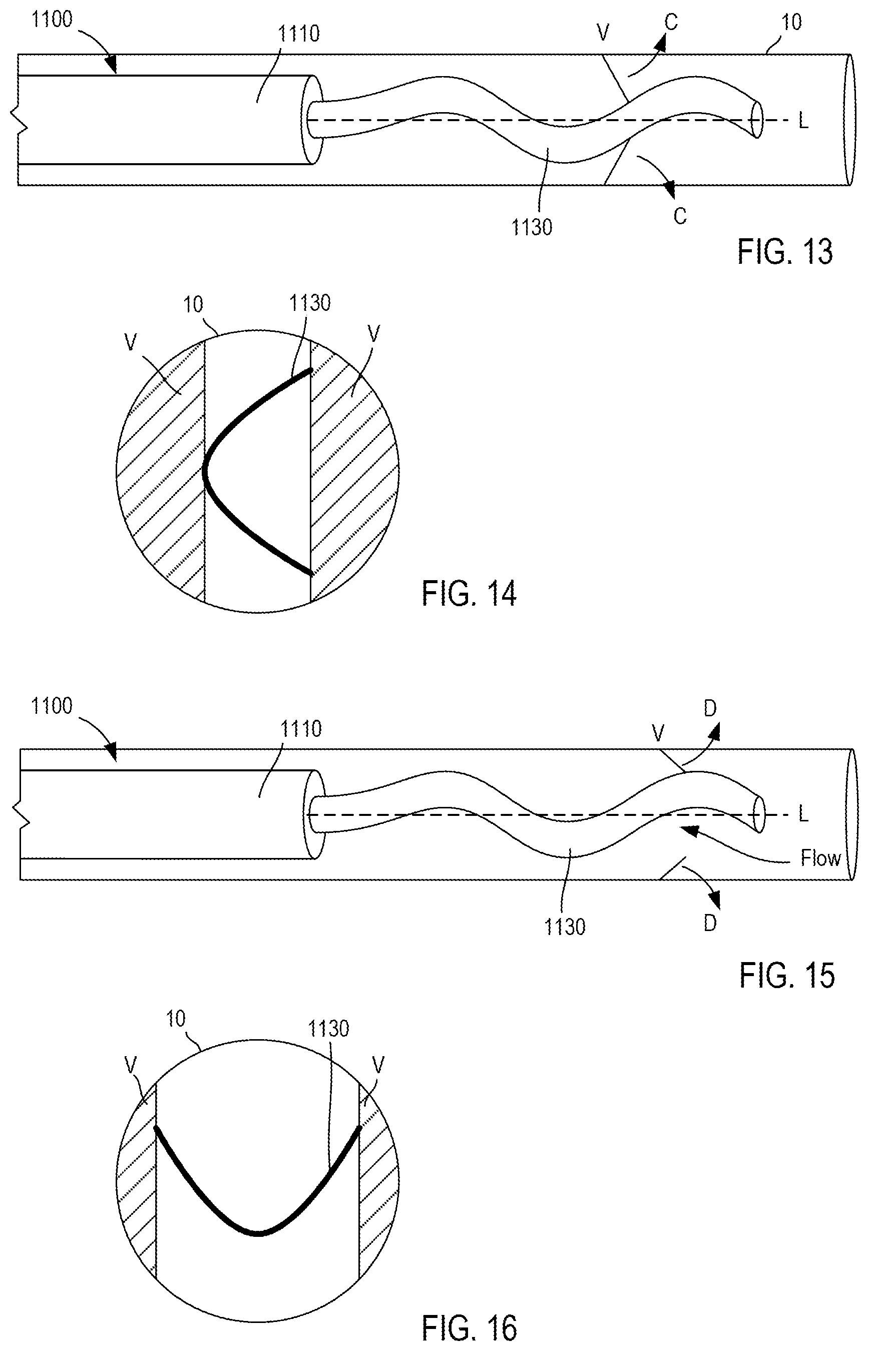 Patent US12303658 Figure 5 – Support devices for bodily fluid transfer systems and methods of using the same