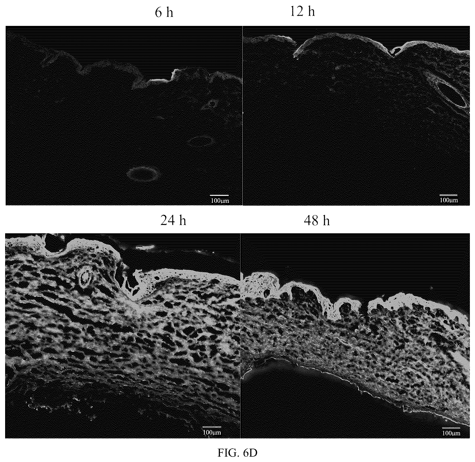 Patent US12303660 Figure 12 – Colchicine hydrogel microneedle and preparation method thereof