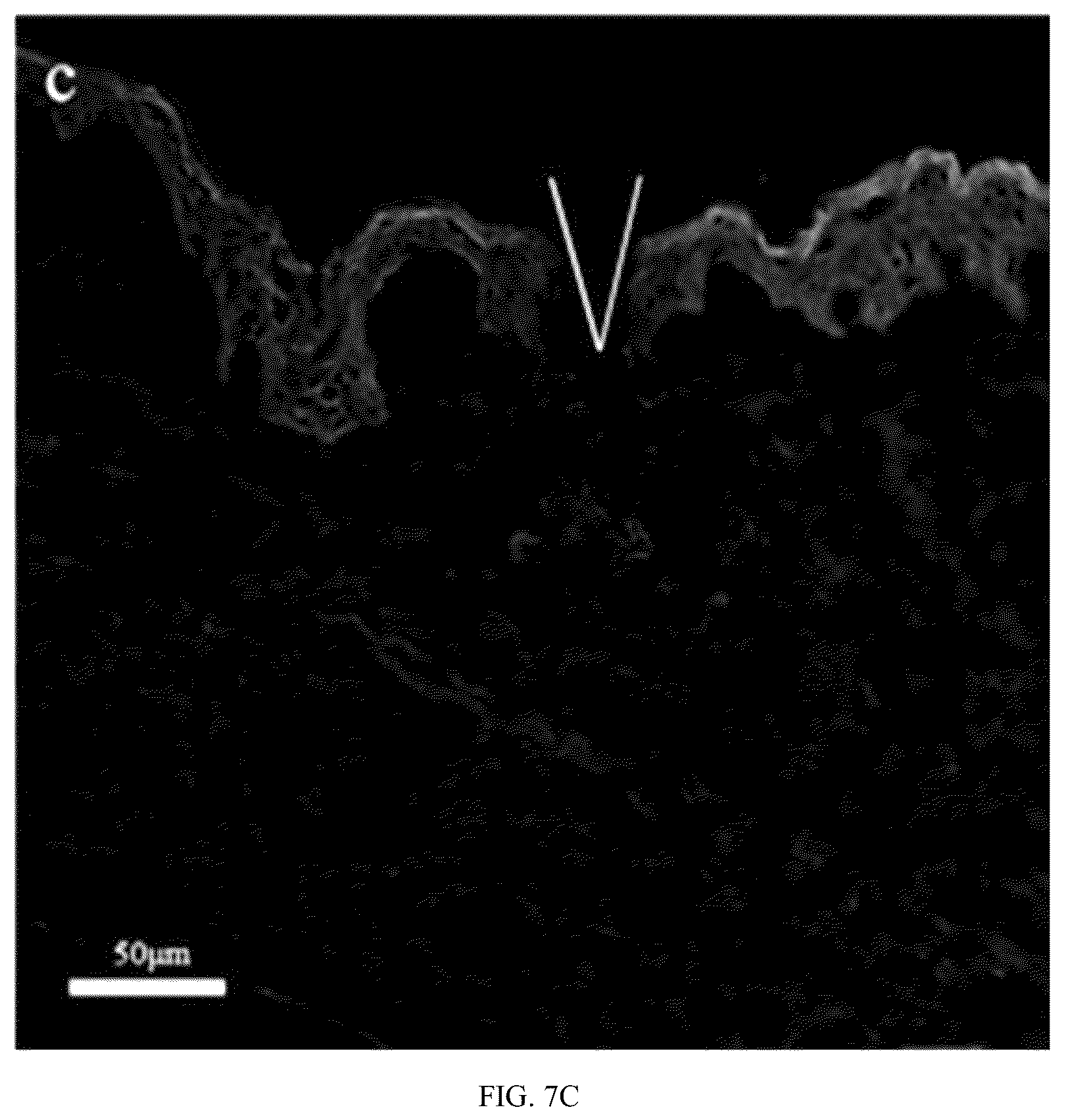 Patent US12303660 Figure 14 – Colchicine hydrogel microneedle and preparation method thereof