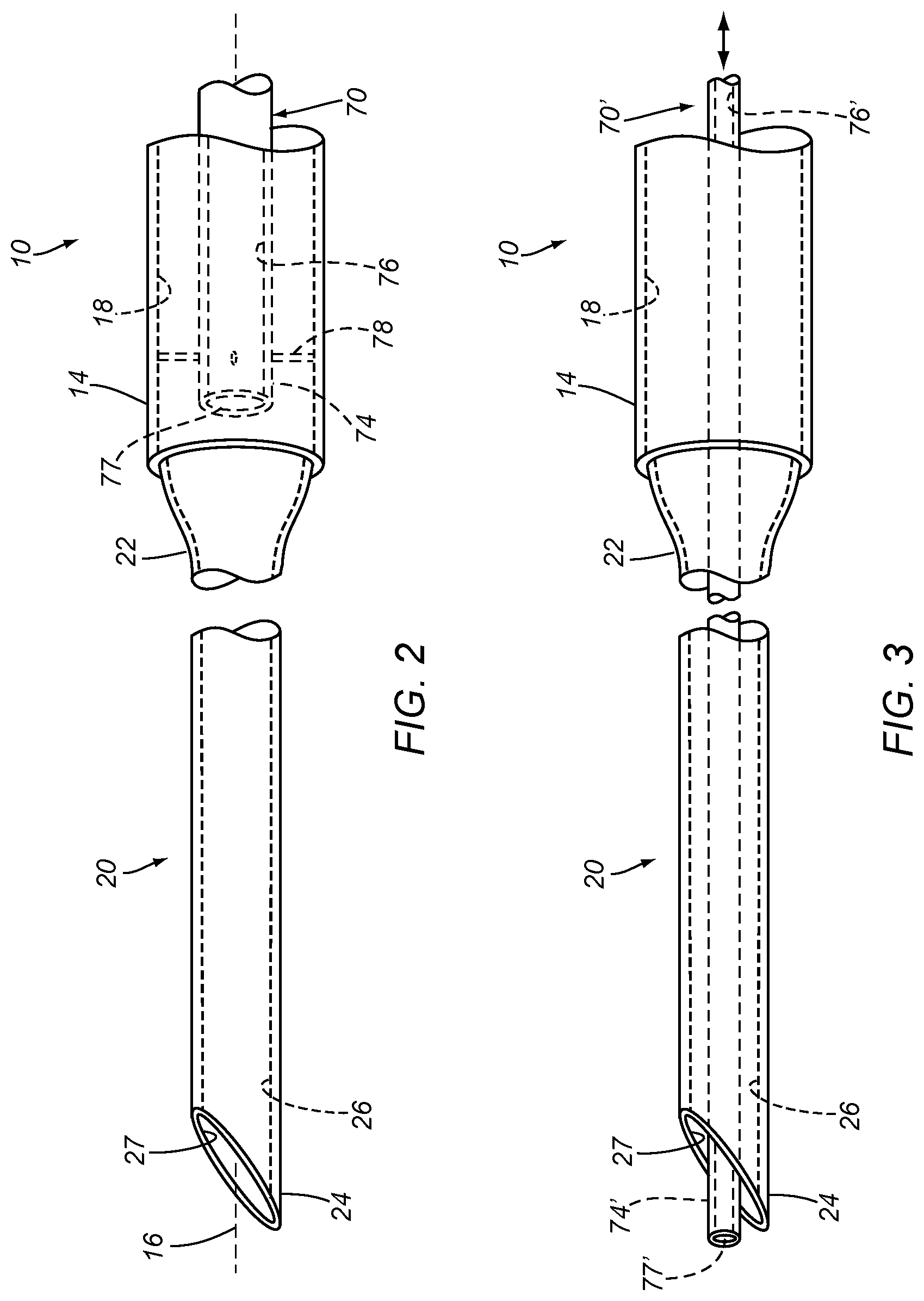 Patent US12303662 Figure 2 – Injection devices and systems and methods for using them