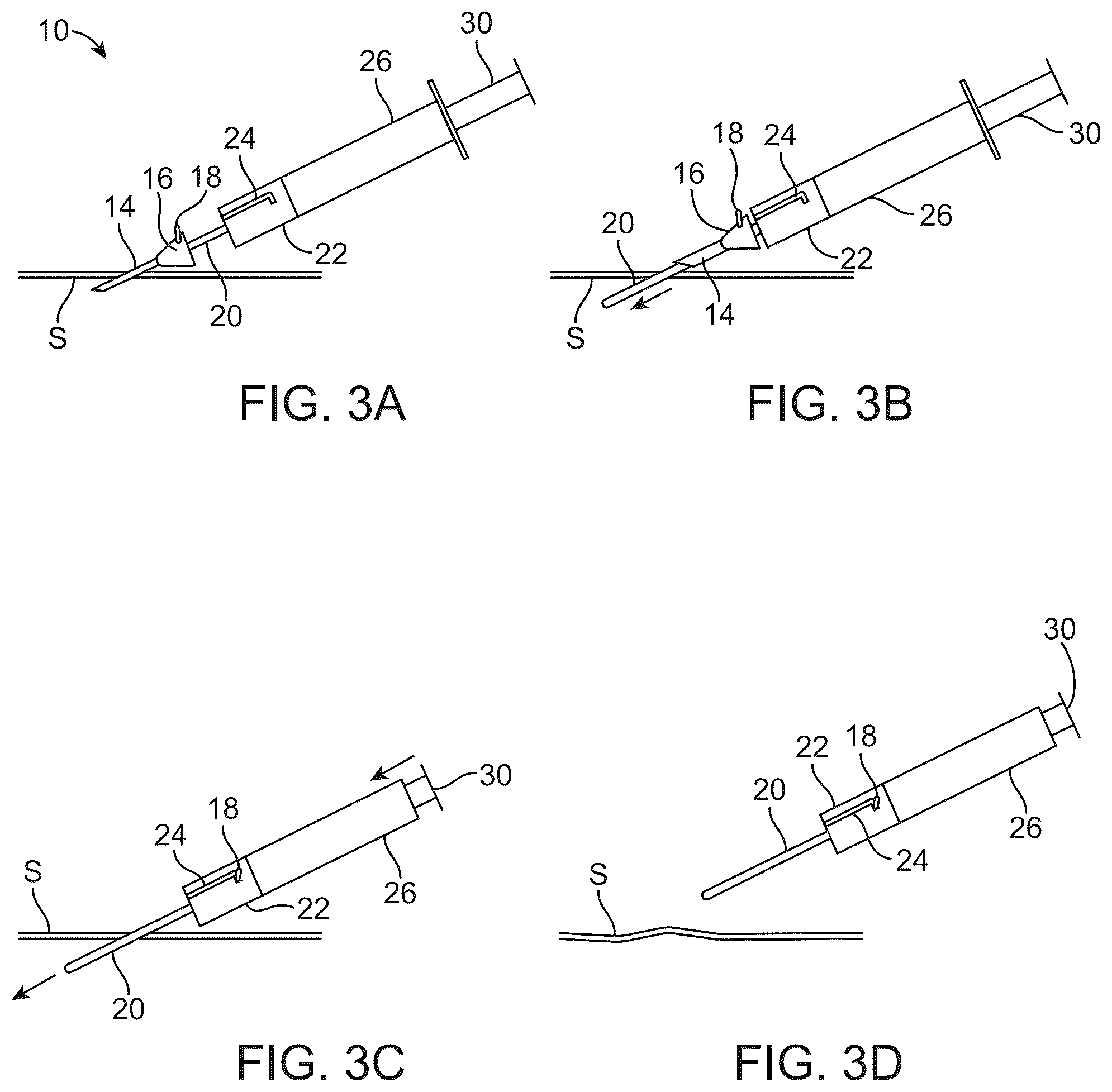 Patent US12303676 Figure 4 – Combined needle and cannula