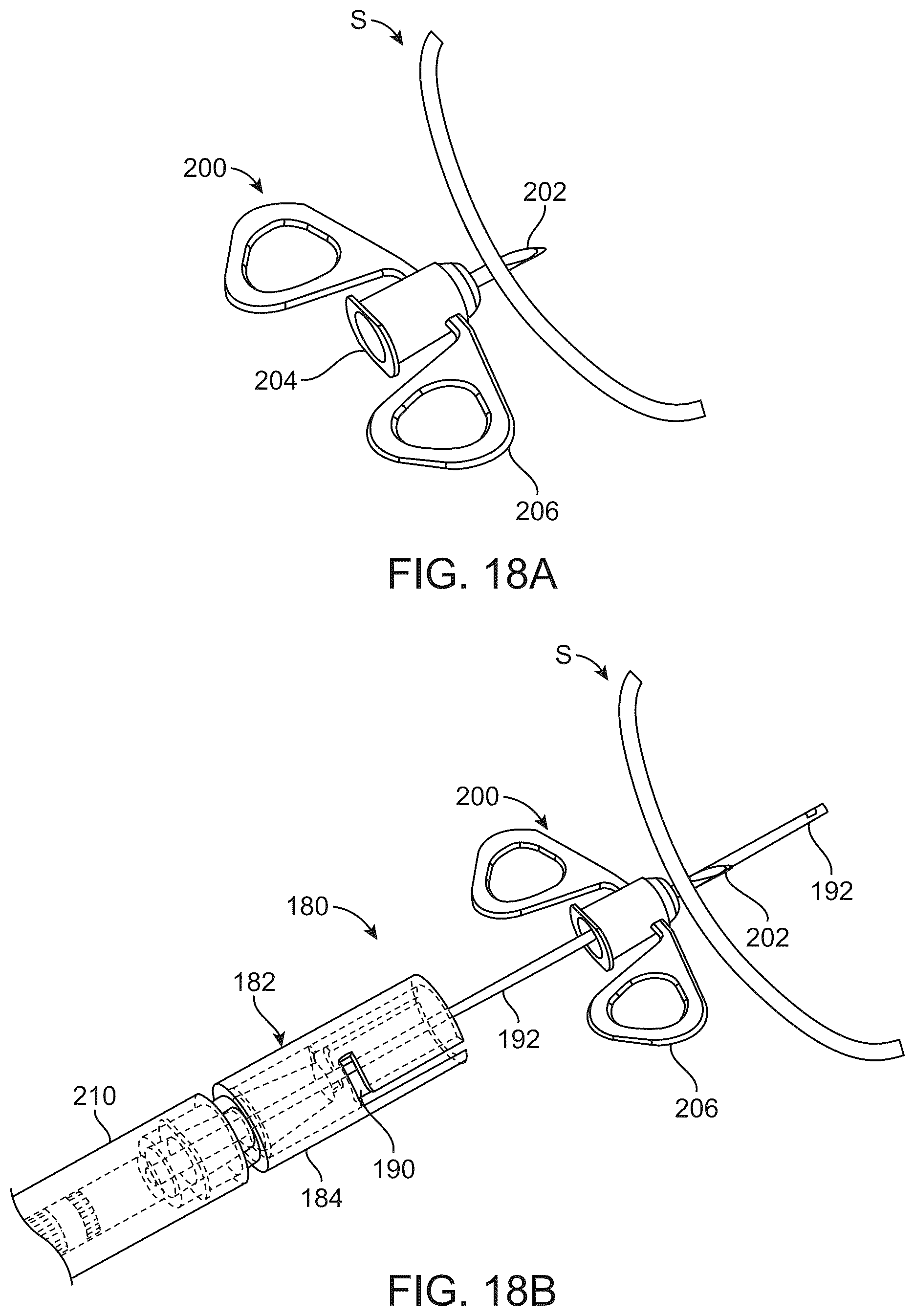 Patent US12303676 Figure 17 – Combined needle and cannula