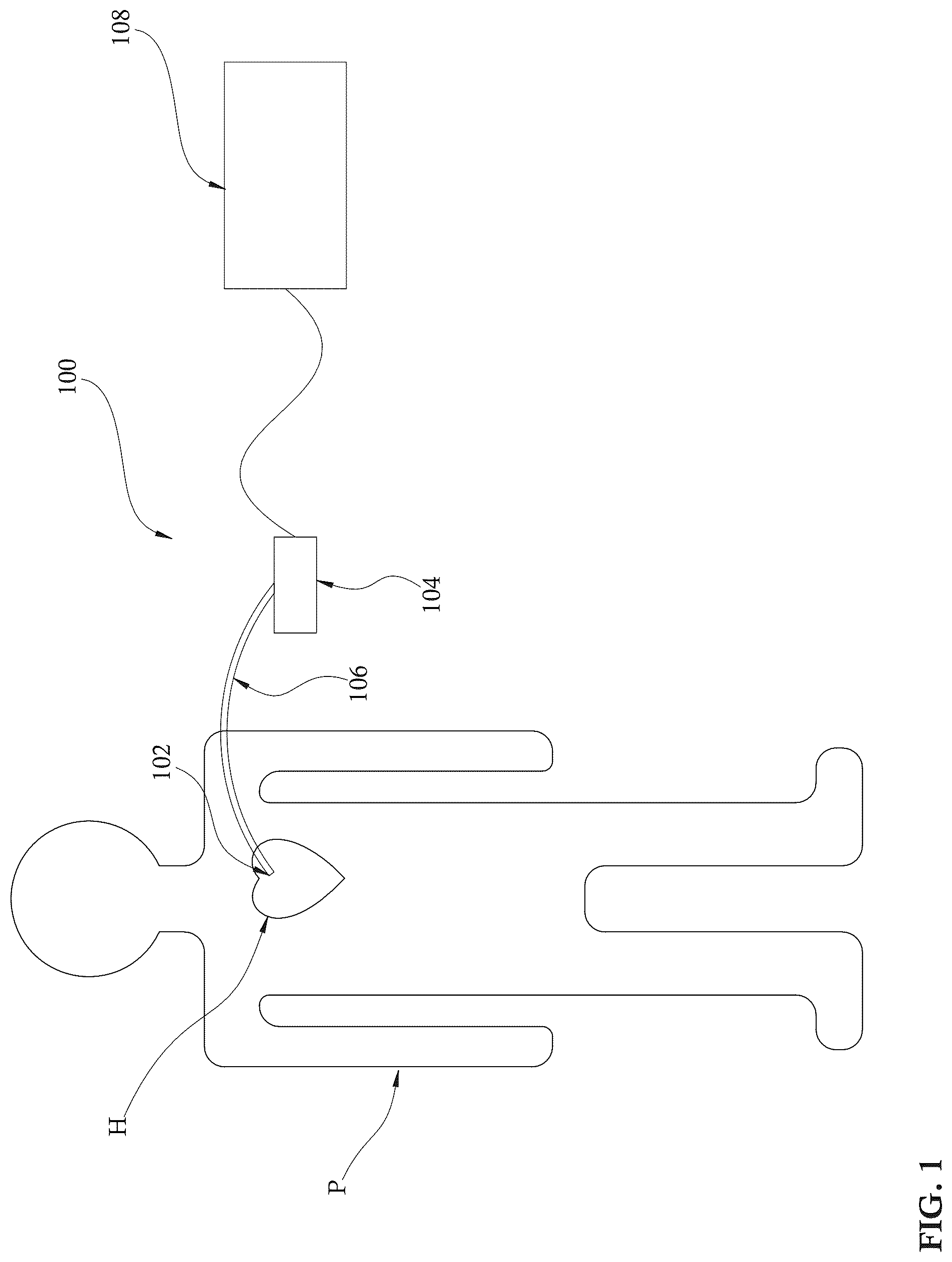 Patent US12303679 Figure 1 – Expandable mechanical hemodynamic support systems, devices, and methods
