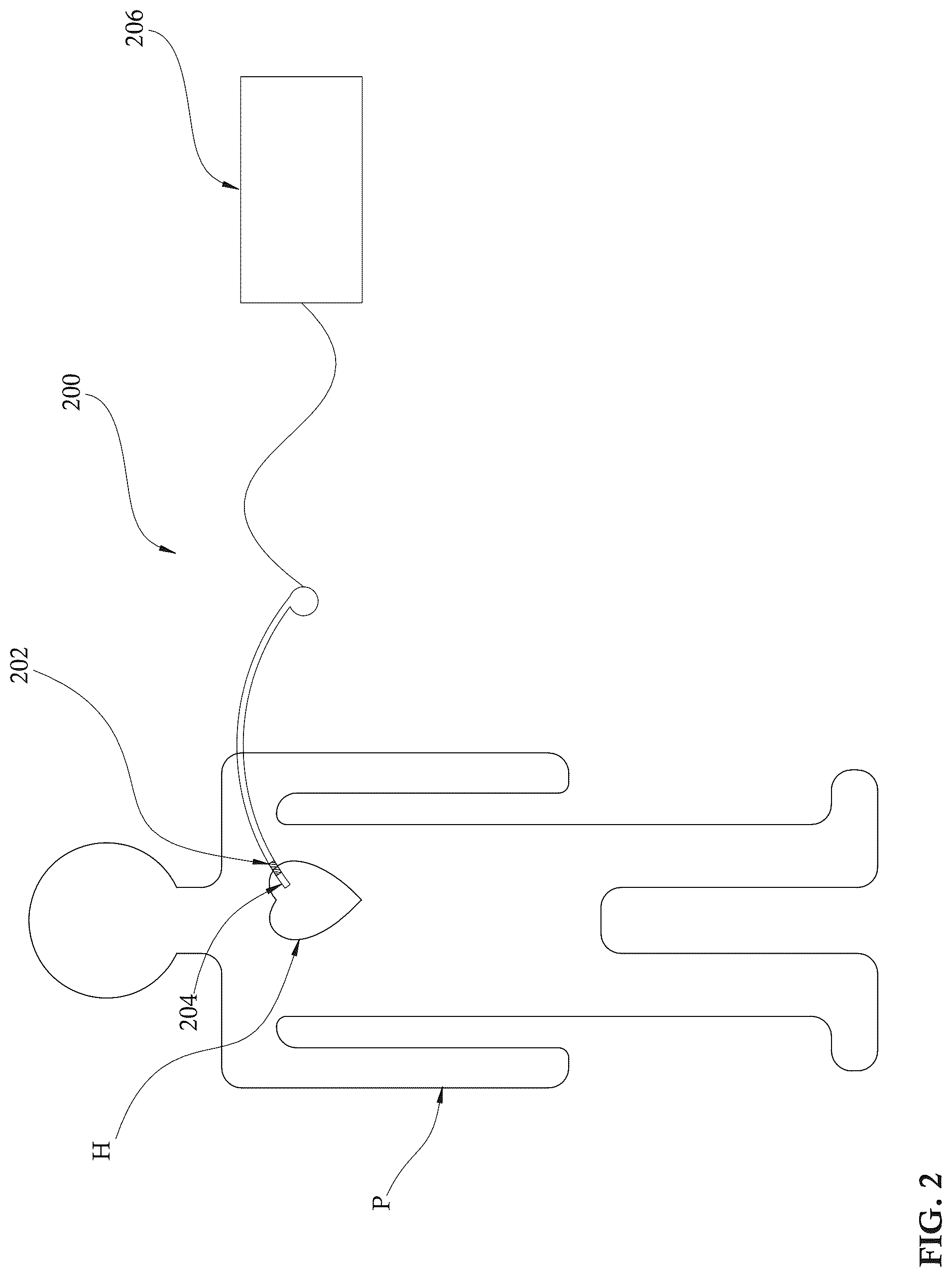 Patent US12303679 Figure 2 – Expandable mechanical hemodynamic support systems, devices, and methods