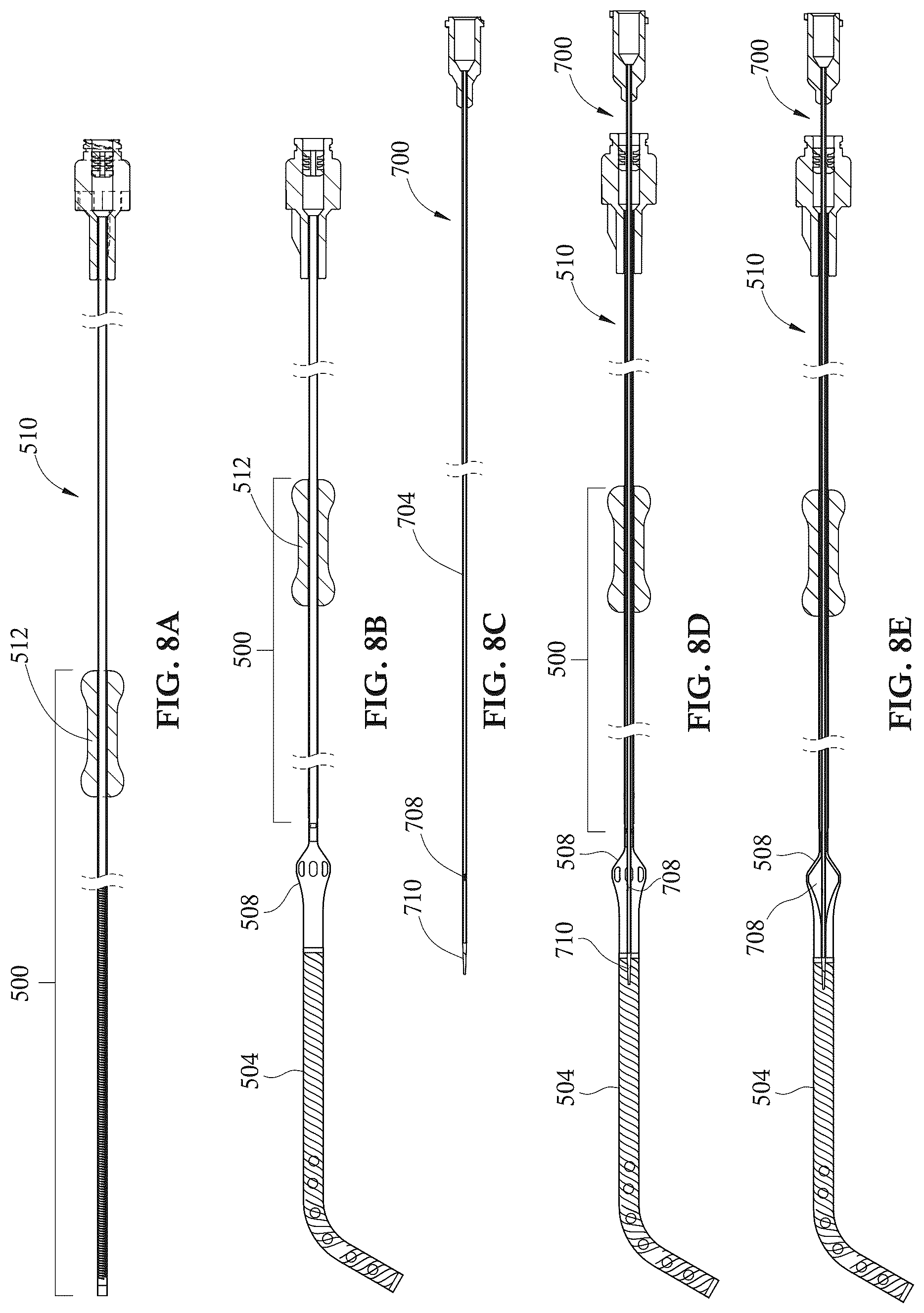 Patent US12303679 Figure 9 – Expandable mechanical hemodynamic support systems, devices, and methods