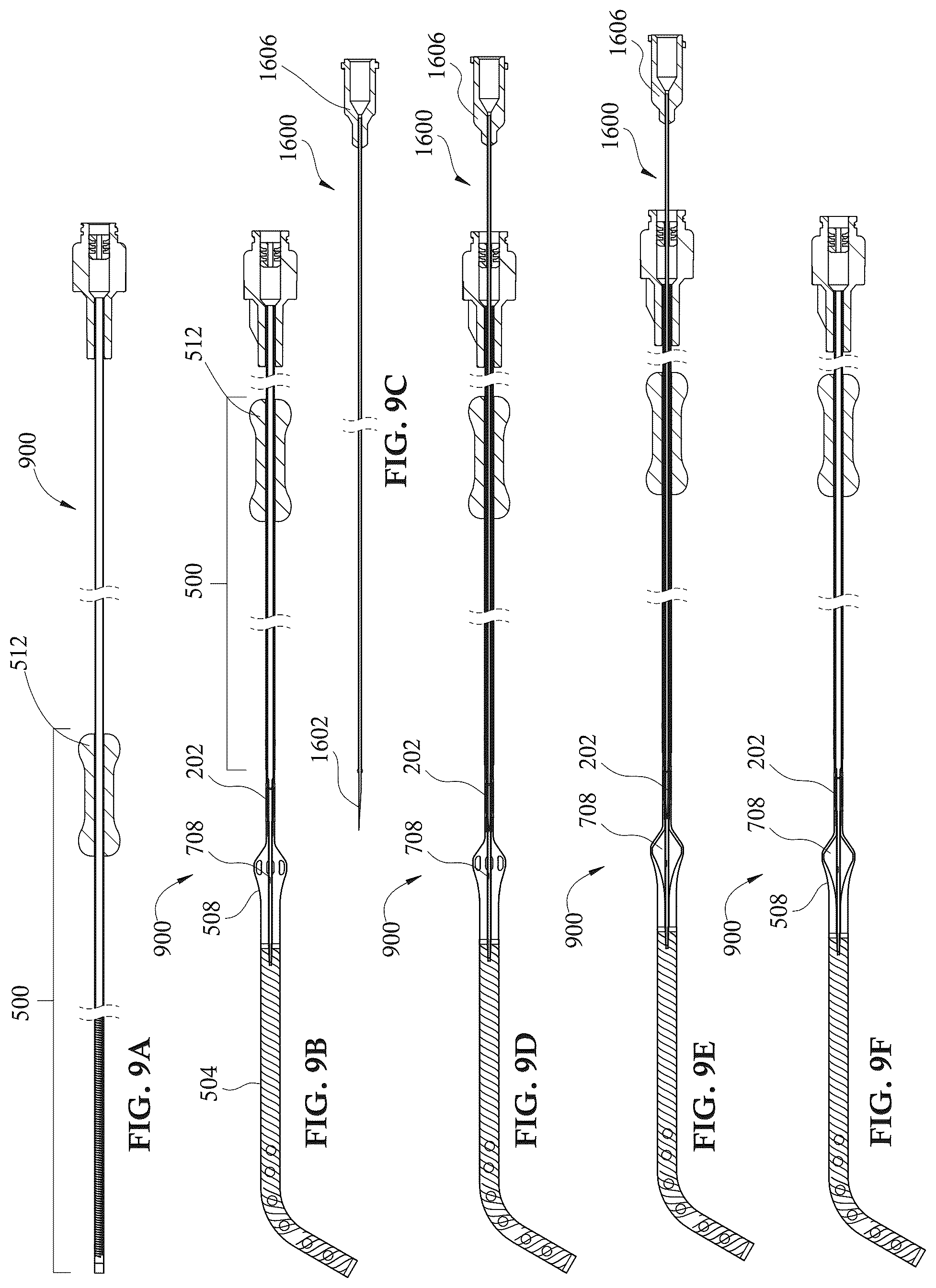 Patent US12303679 Figure 10 – Expandable mechanical hemodynamic support systems, devices, and methods