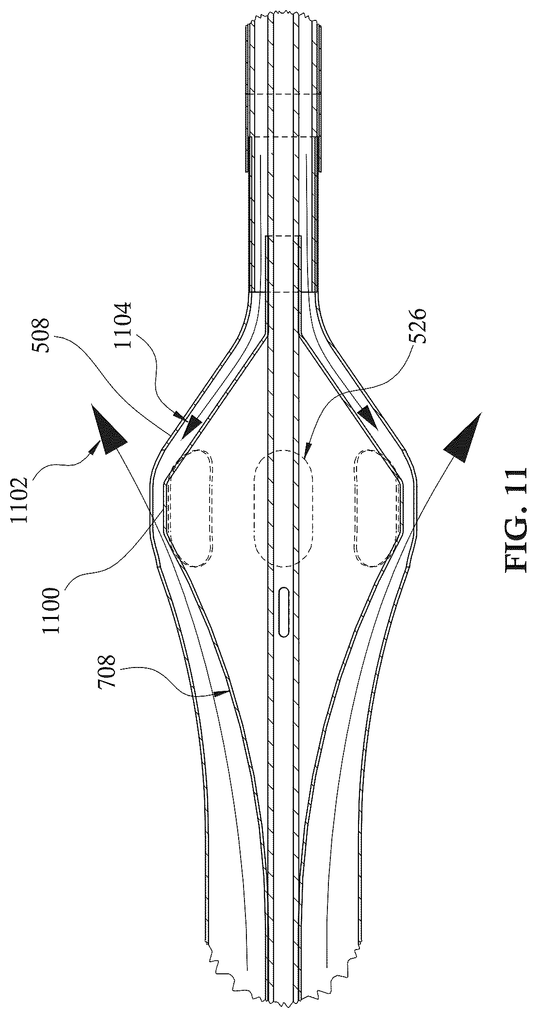 Patent US12303679 Figure 12 – Expandable mechanical hemodynamic support systems, devices, and methods