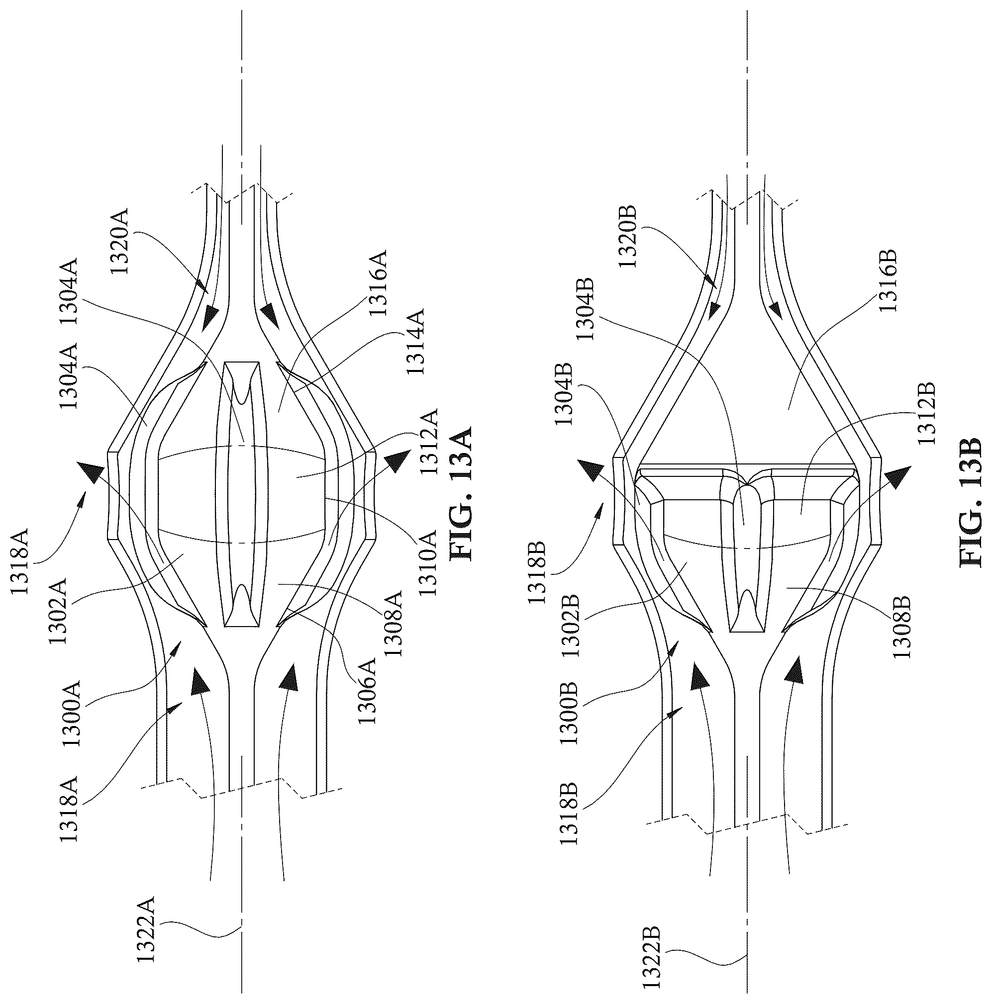 Patent US12303679 Figure 14 – Expandable mechanical hemodynamic support systems, devices, and methods