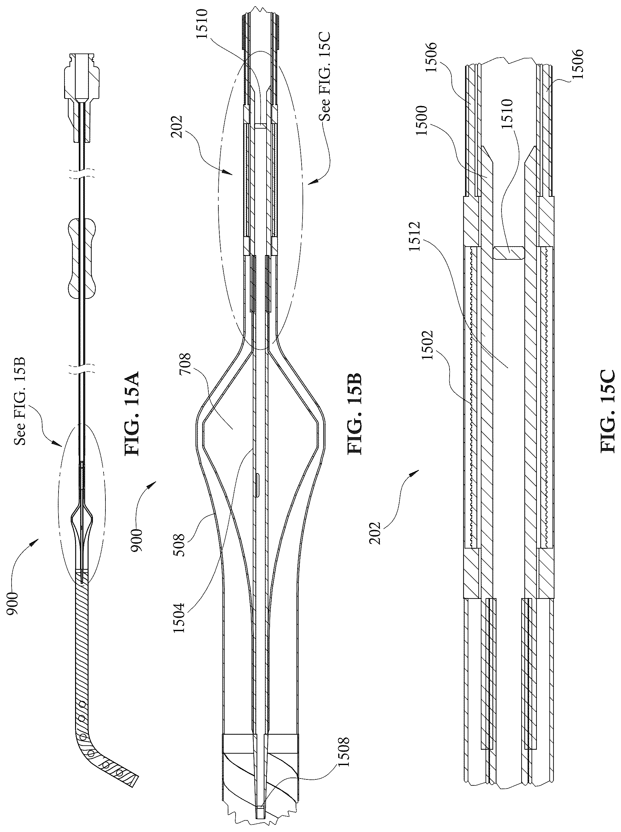 Patent US12303679 Figure 16 – Expandable mechanical hemodynamic support systems, devices, and methods