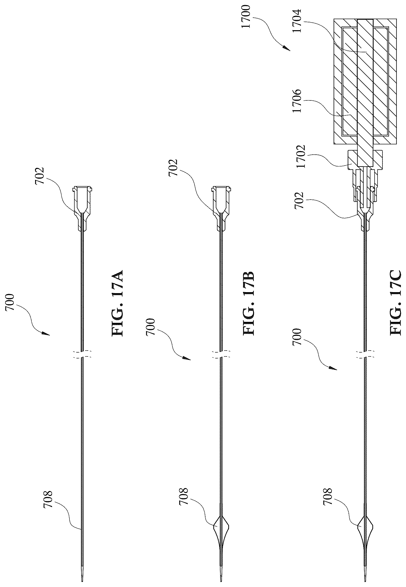 Patent US12303679 Figure 18 – Expandable mechanical hemodynamic support systems, devices, and methods