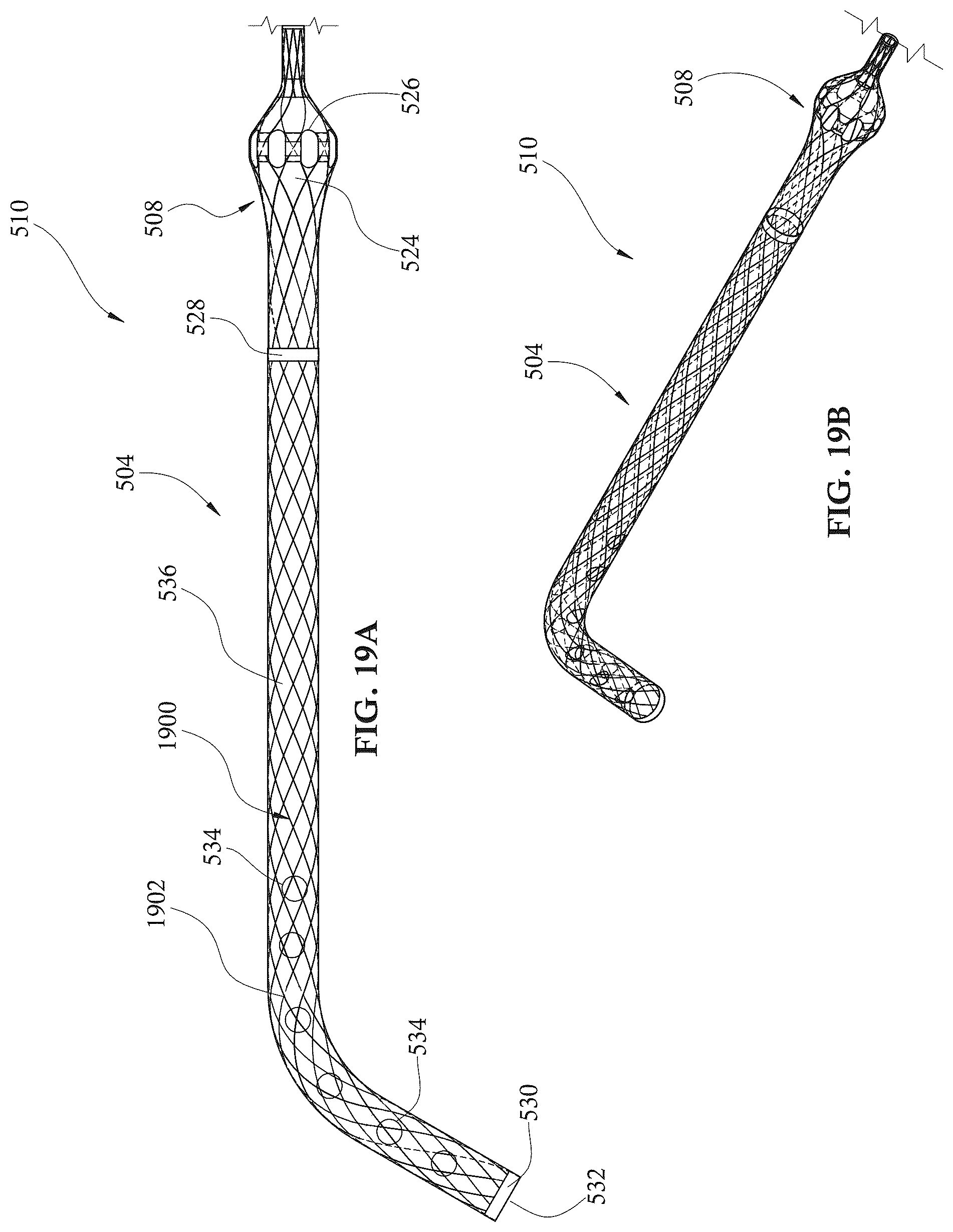 Patent US12303679 Figure 20 – Expandable mechanical hemodynamic support systems, devices, and methods