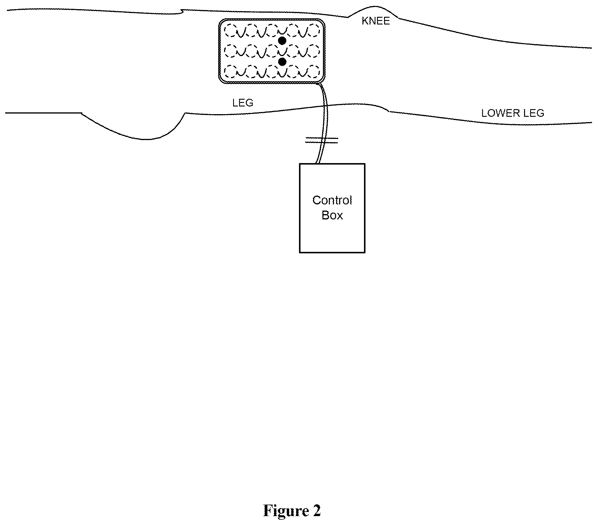 Patent US12303681 Figure 2 – Systems and methods for automated muscle stimulation