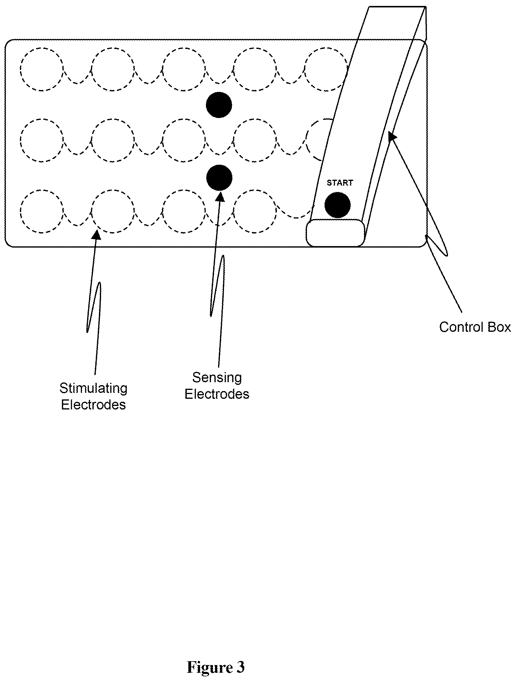Patent US12303681 Figure 3 – Systems and methods for automated muscle stimulation