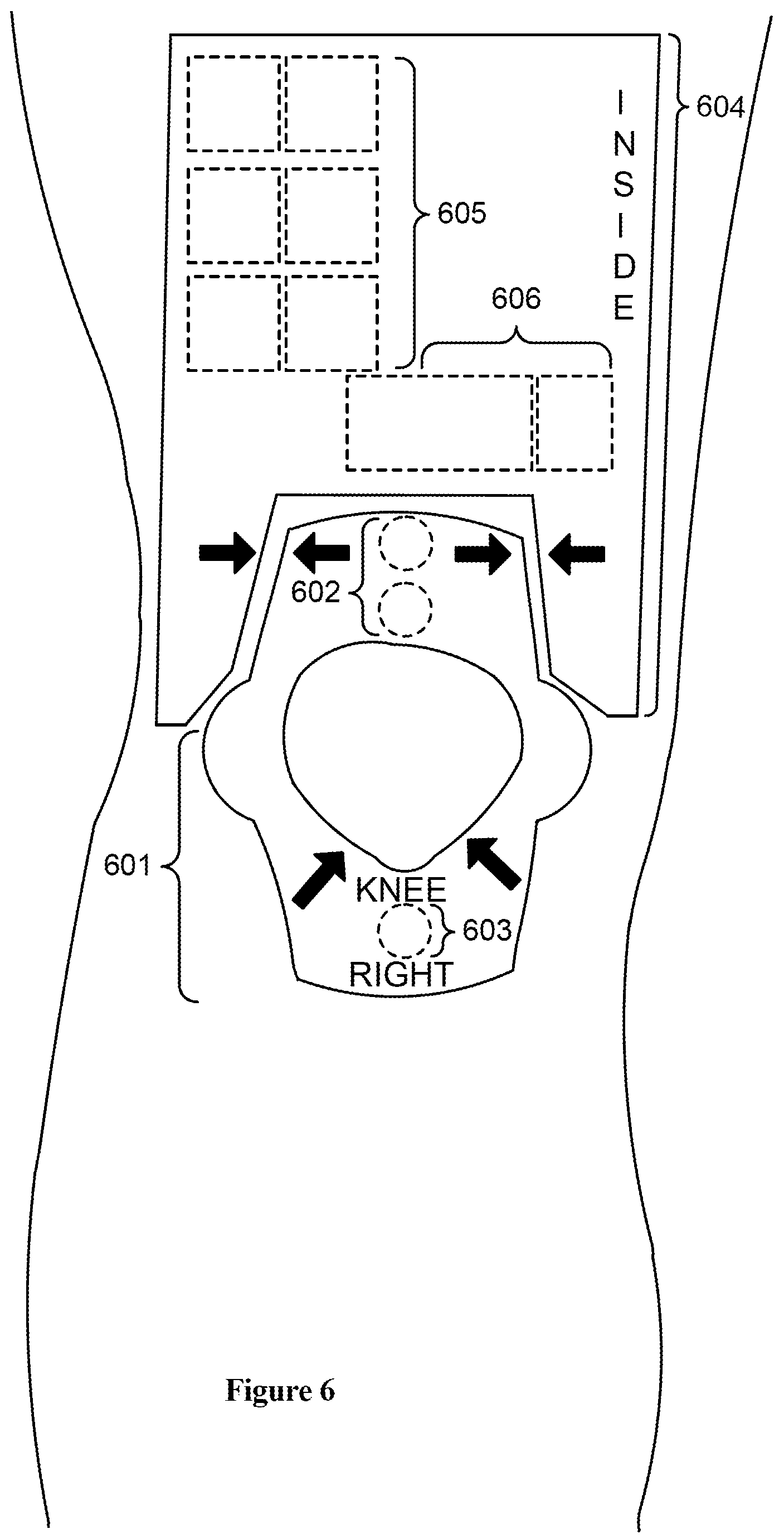 Patent US12303681 Figure 6 – Systems and methods for automated muscle stimulation