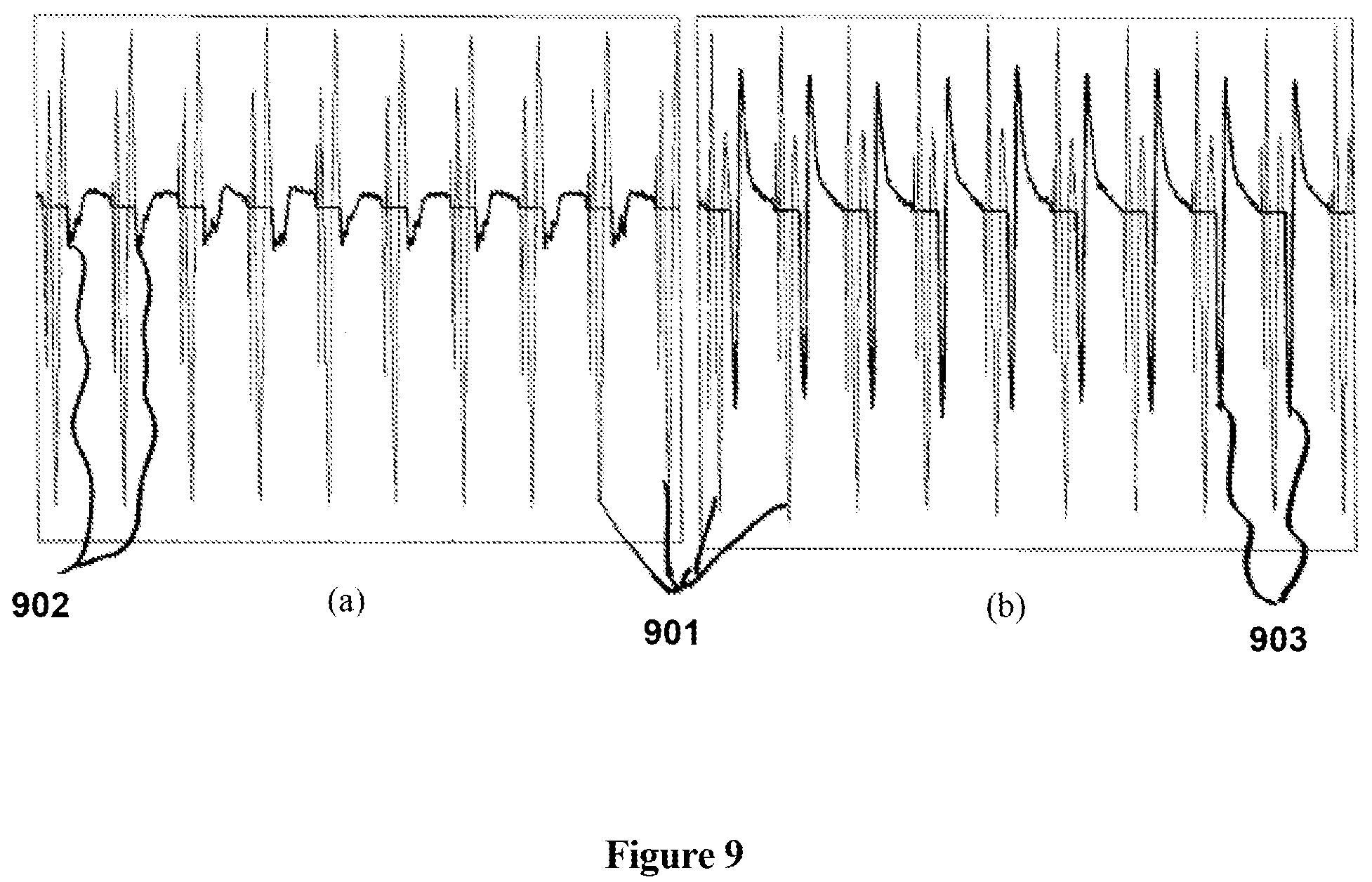 Patent US12303681 Figure 9 – Systems and methods for automated muscle stimulation