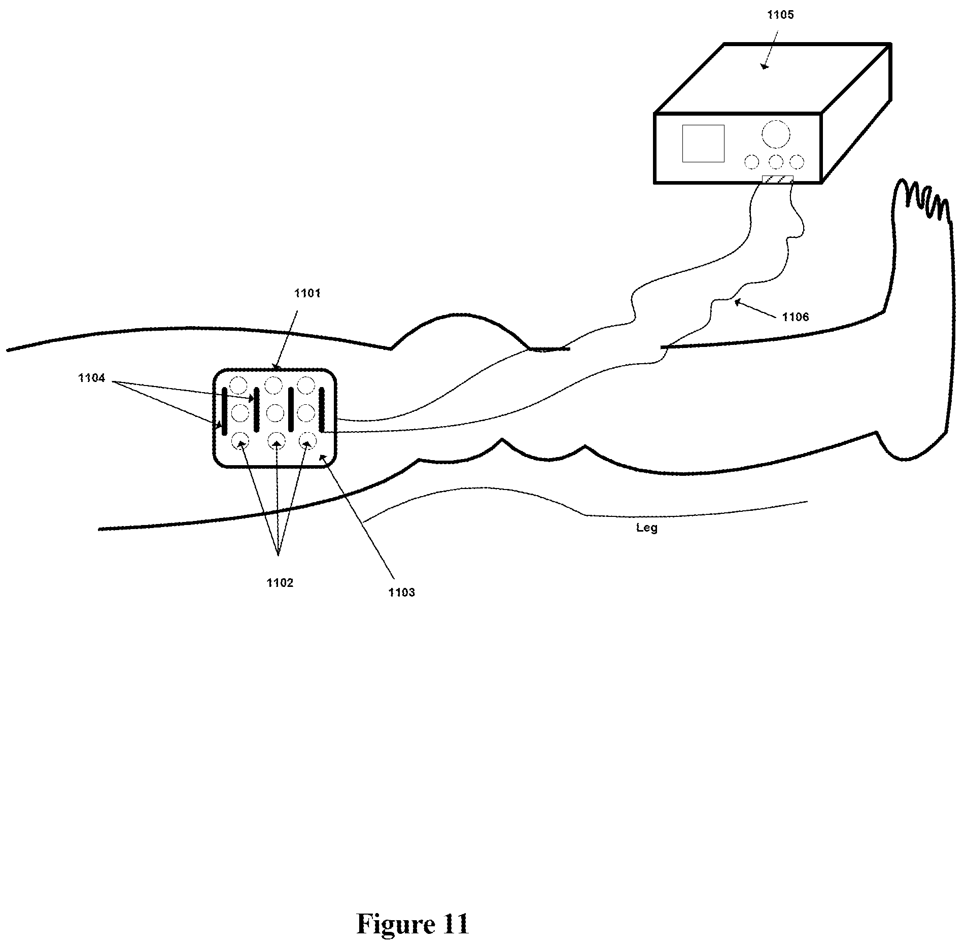 Patent US12303681 Figure 11 – Systems and methods for automated muscle stimulation