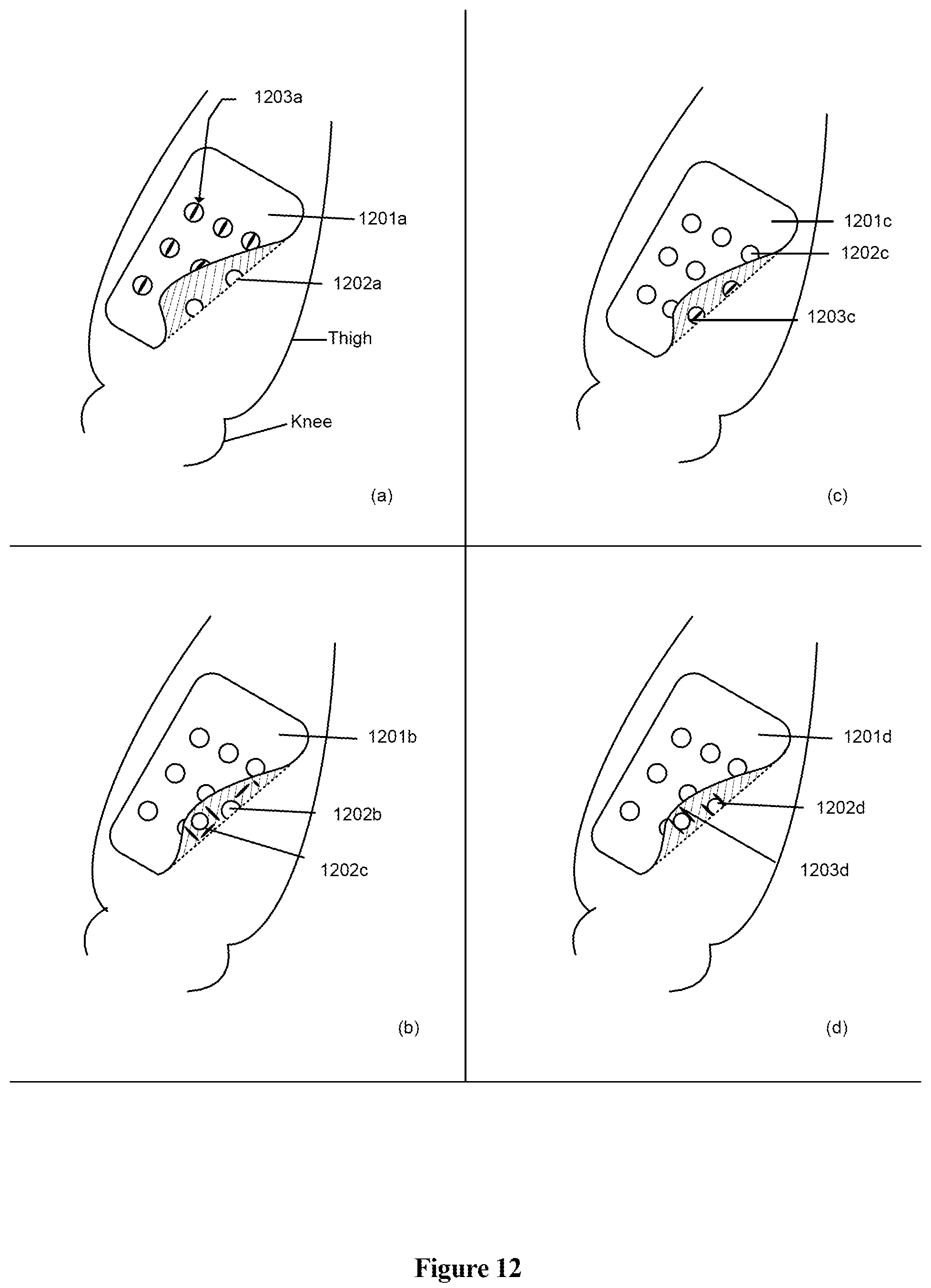 Patent US12303681 Figure 12 – Systems and methods for automated muscle stimulation