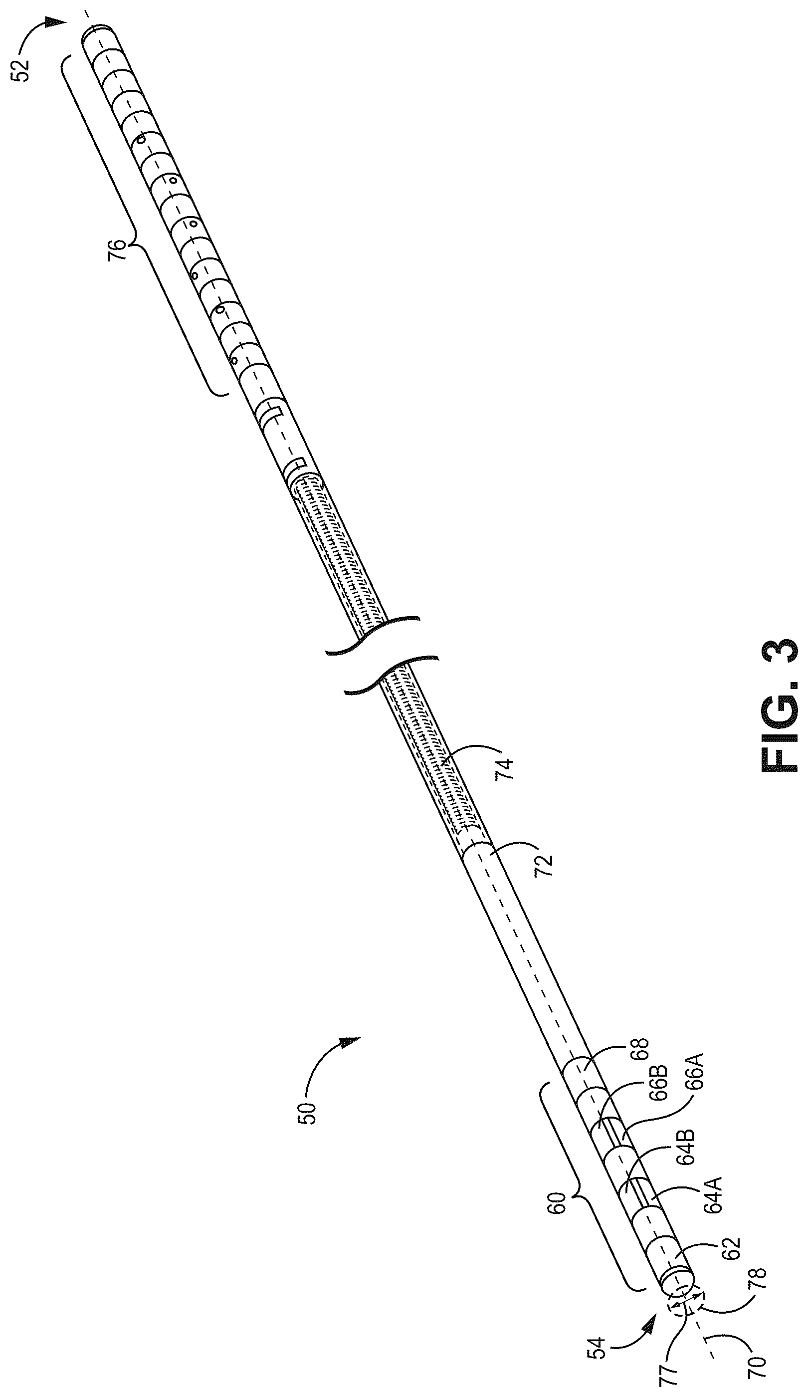 Patent US12303682 Figure 3 – Medical lead with segmented electrodes