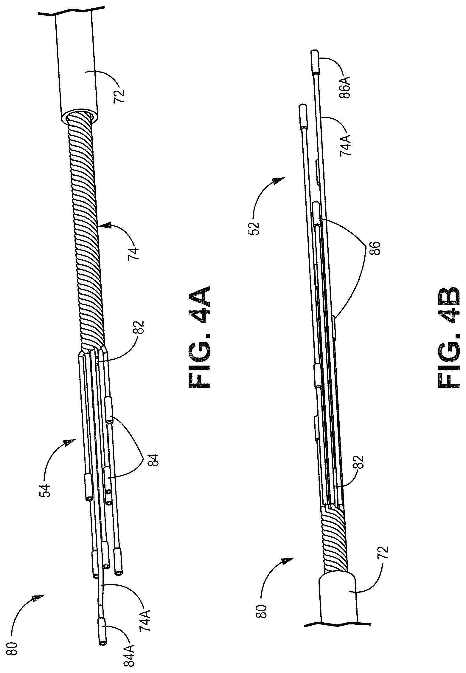 Patent US12303682 Figure 4 – Medical lead with segmented electrodes