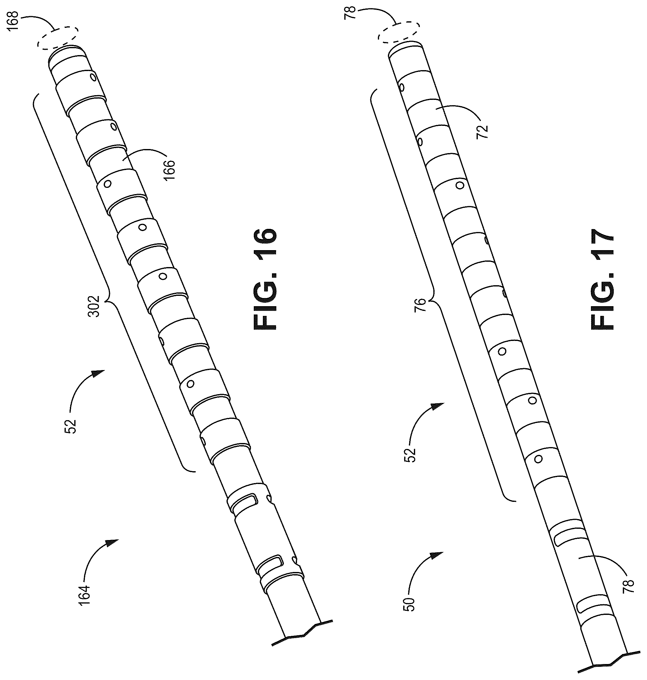 Patent US12303682 Figure 17 – Medical lead with segmented electrodes