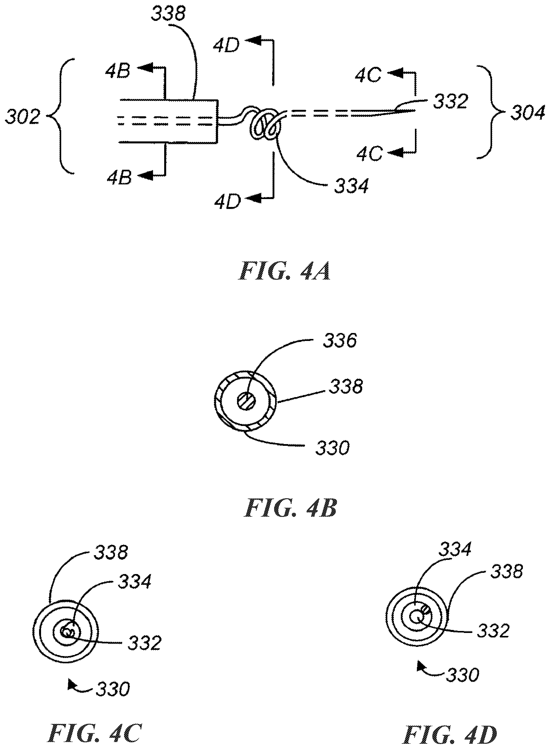 Patent US12303684 Figure 7 – Transcoronary sinus pacing of posteroseptal left ventricular base