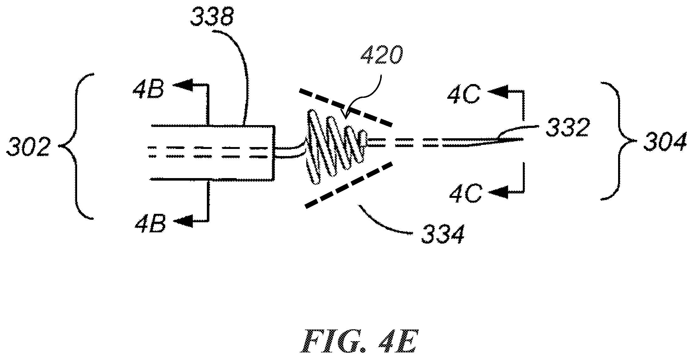 Patent US12303684 Figure 8 – Transcoronary sinus pacing of posteroseptal left ventricular base