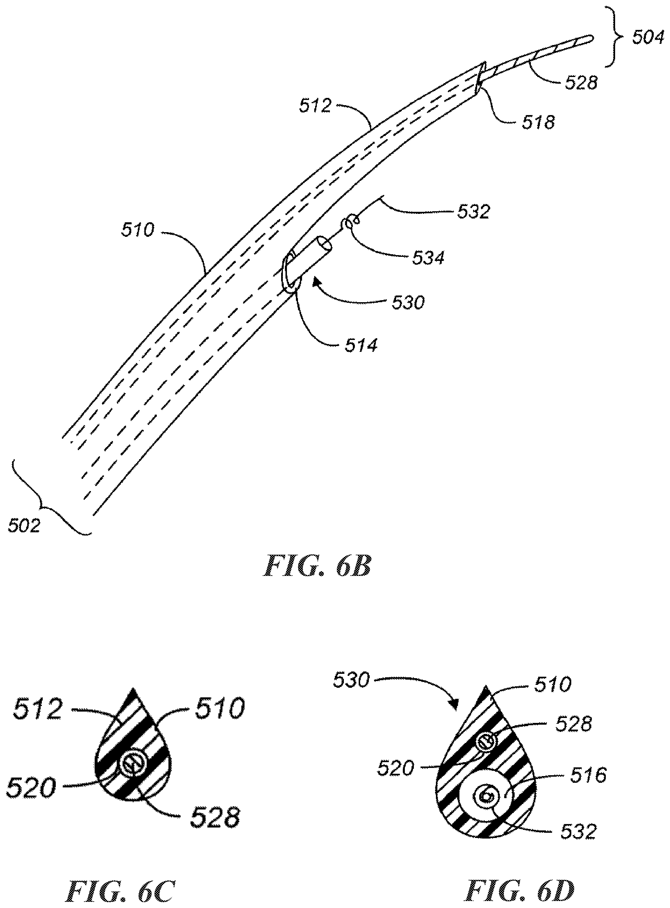 Patent US12303684 Figure 10 – Transcoronary sinus pacing of posteroseptal left ventricular base