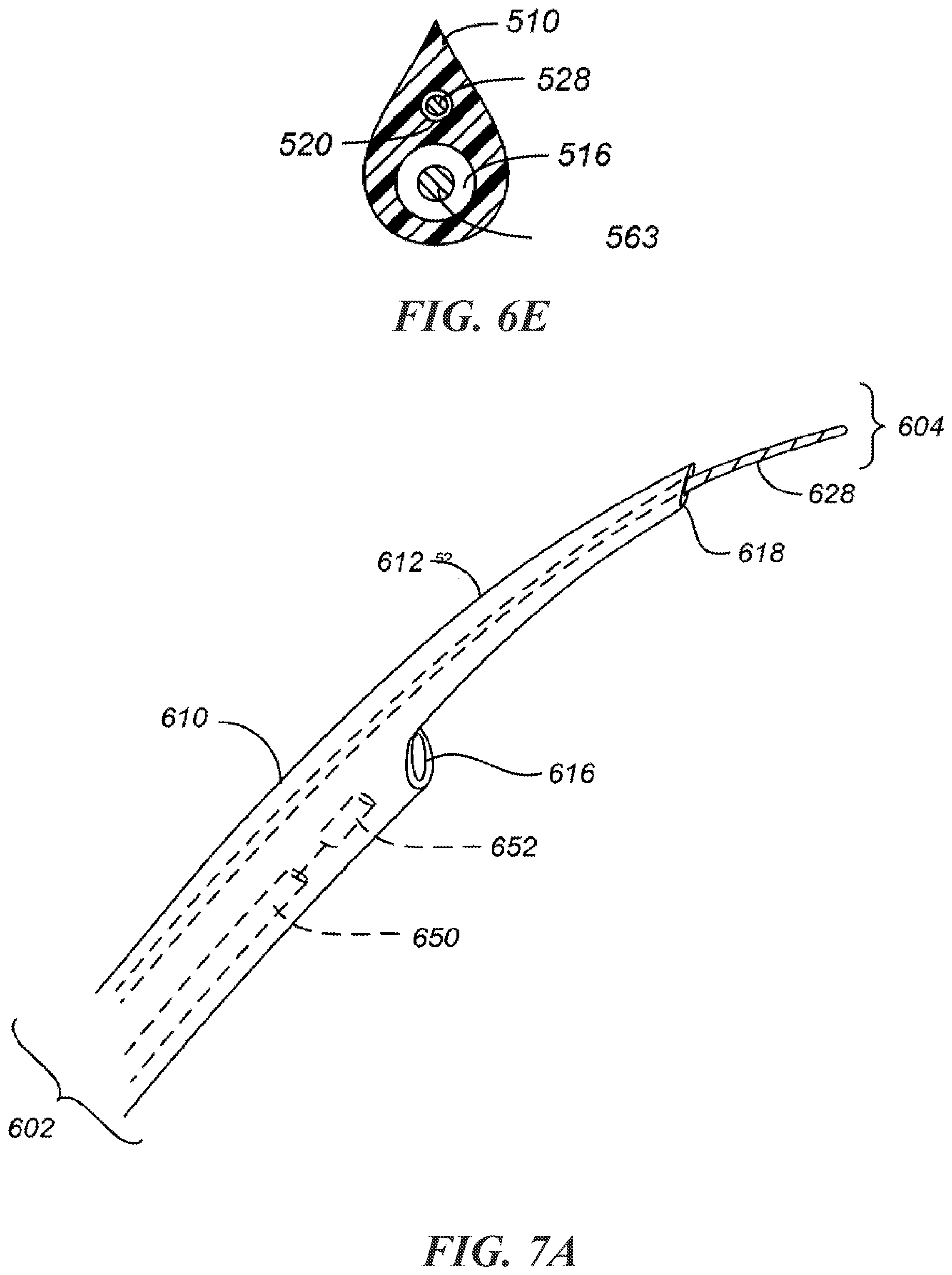 Patent US12303684 Figure 11 – Transcoronary sinus pacing of posteroseptal left ventricular base