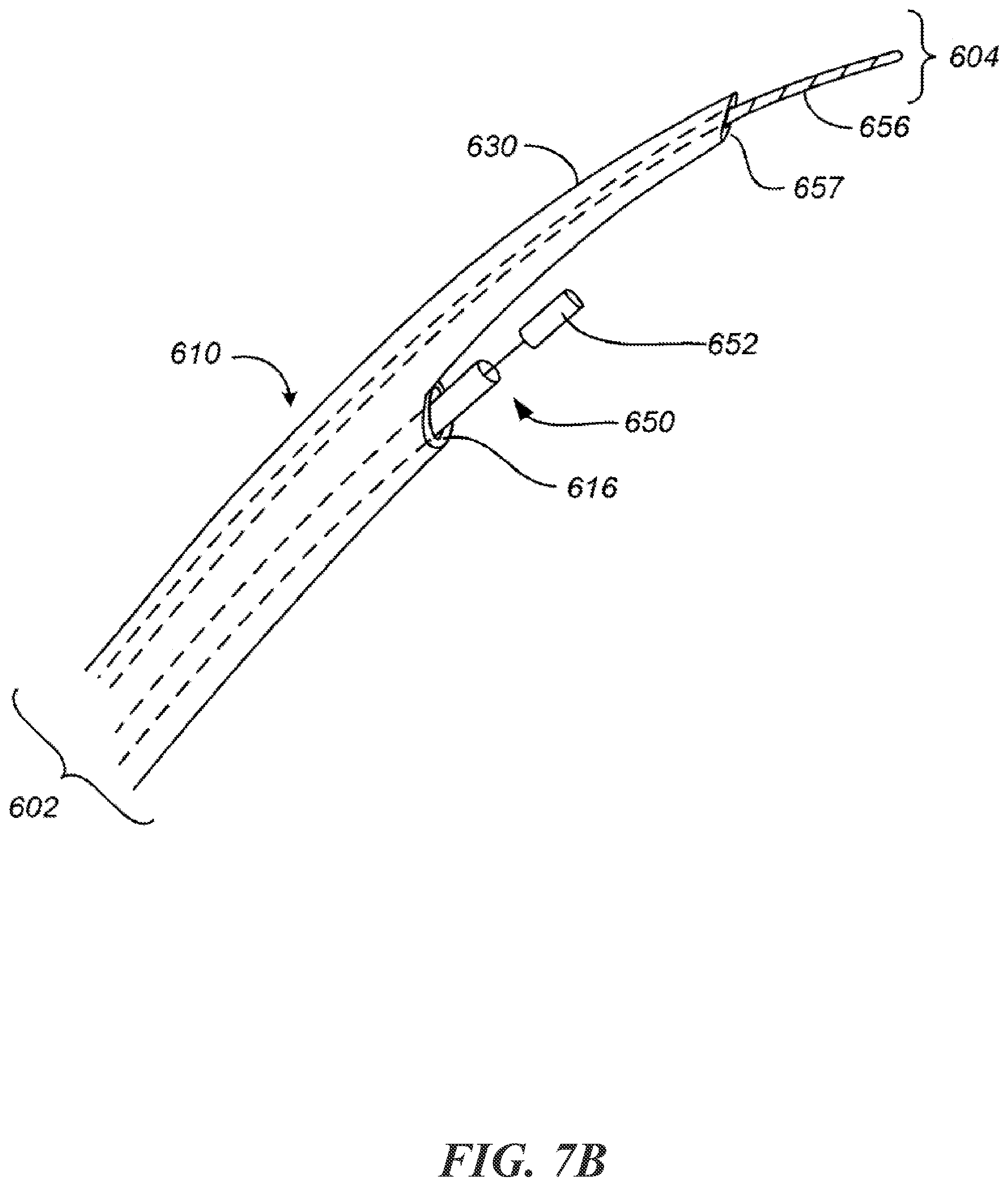 Patent US12303684 Figure 12 – Transcoronary sinus pacing of posteroseptal left ventricular base