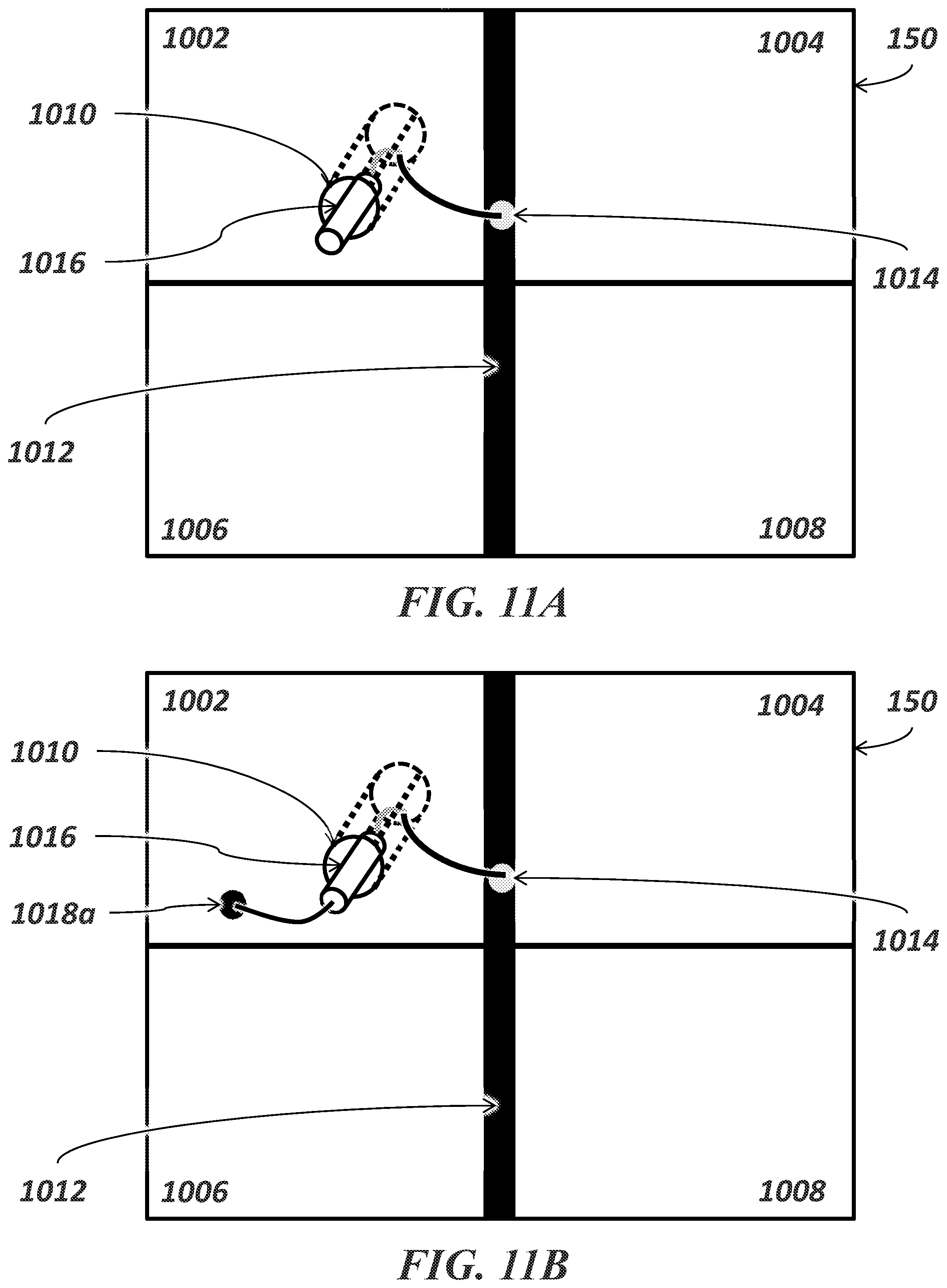 Patent US12303684 Figure 20 – Transcoronary sinus pacing of posteroseptal left ventricular base